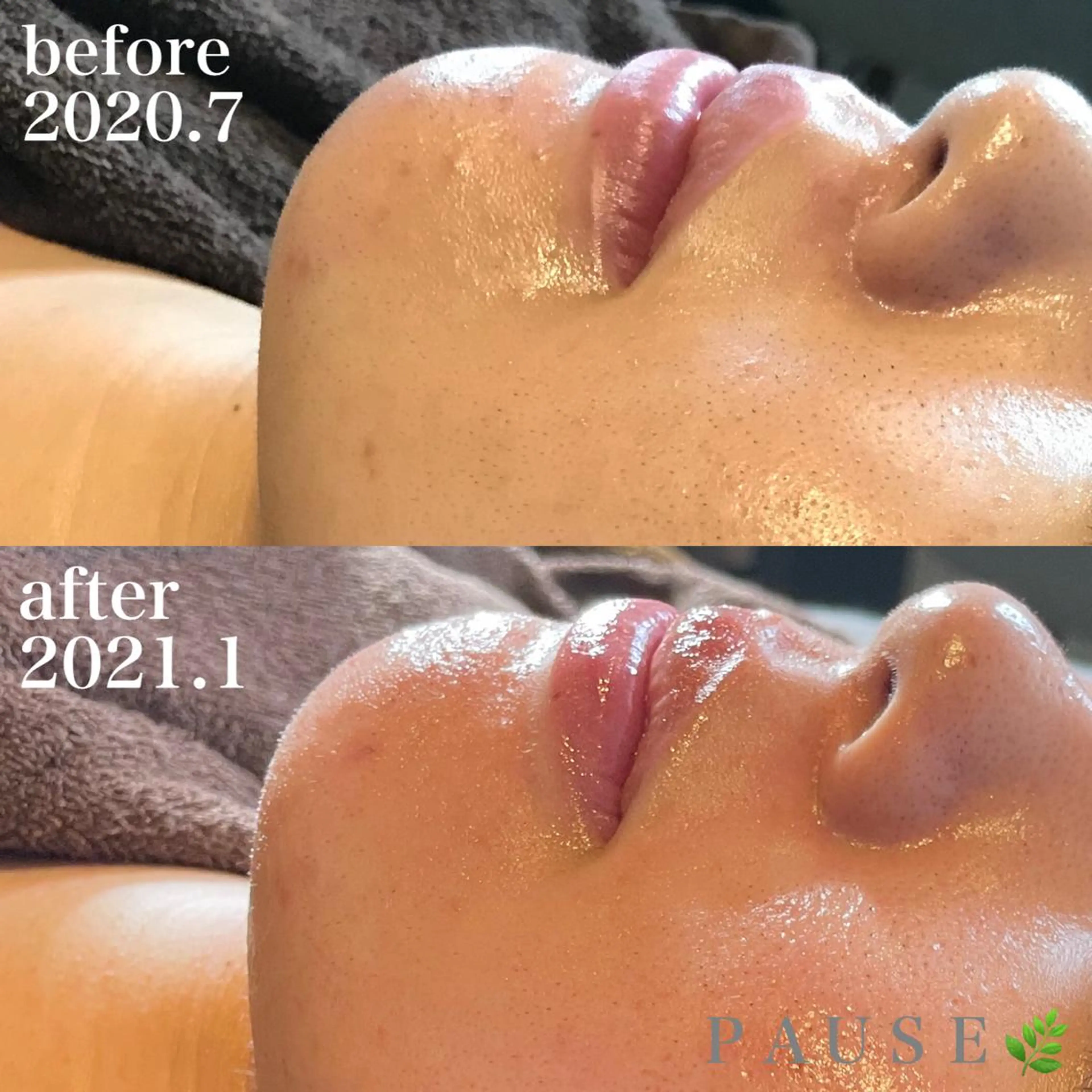 エステ 浜野 恵美のエステ・リラクイメージ