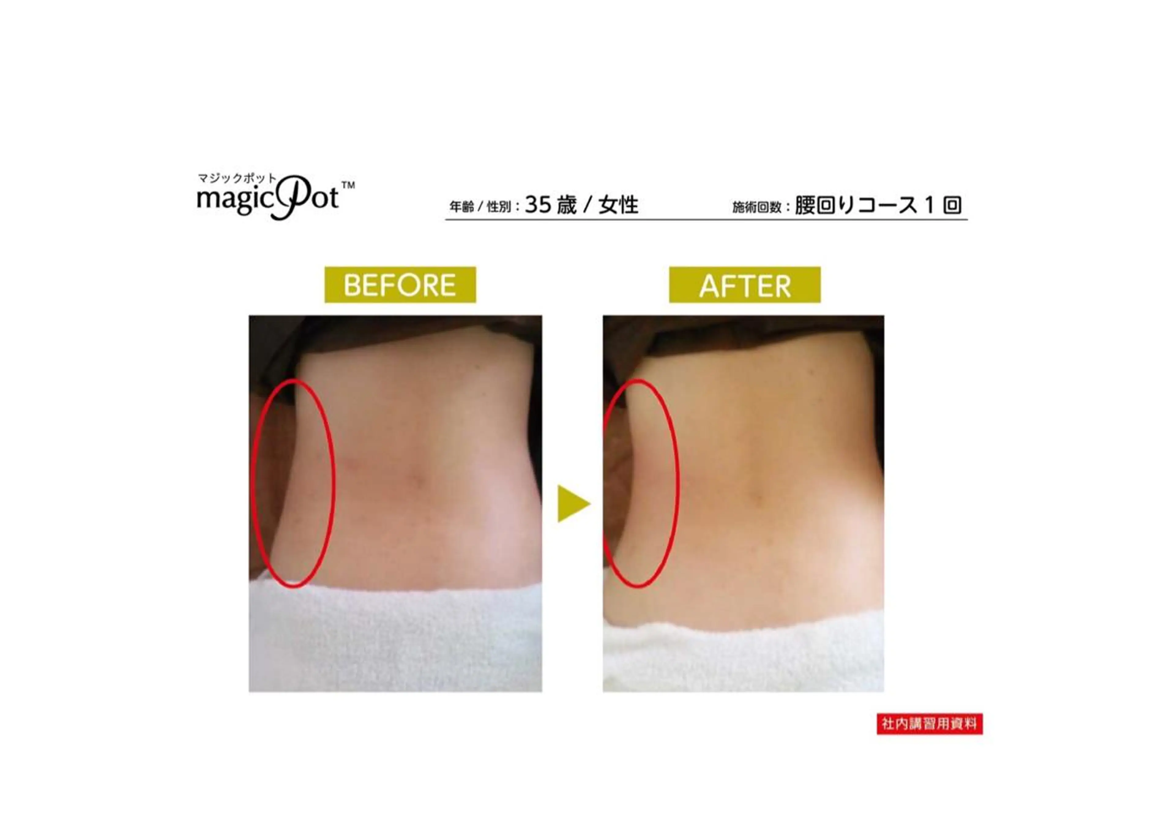 脱毛・エステサロン LuLuNのエステ・リラクイメージ