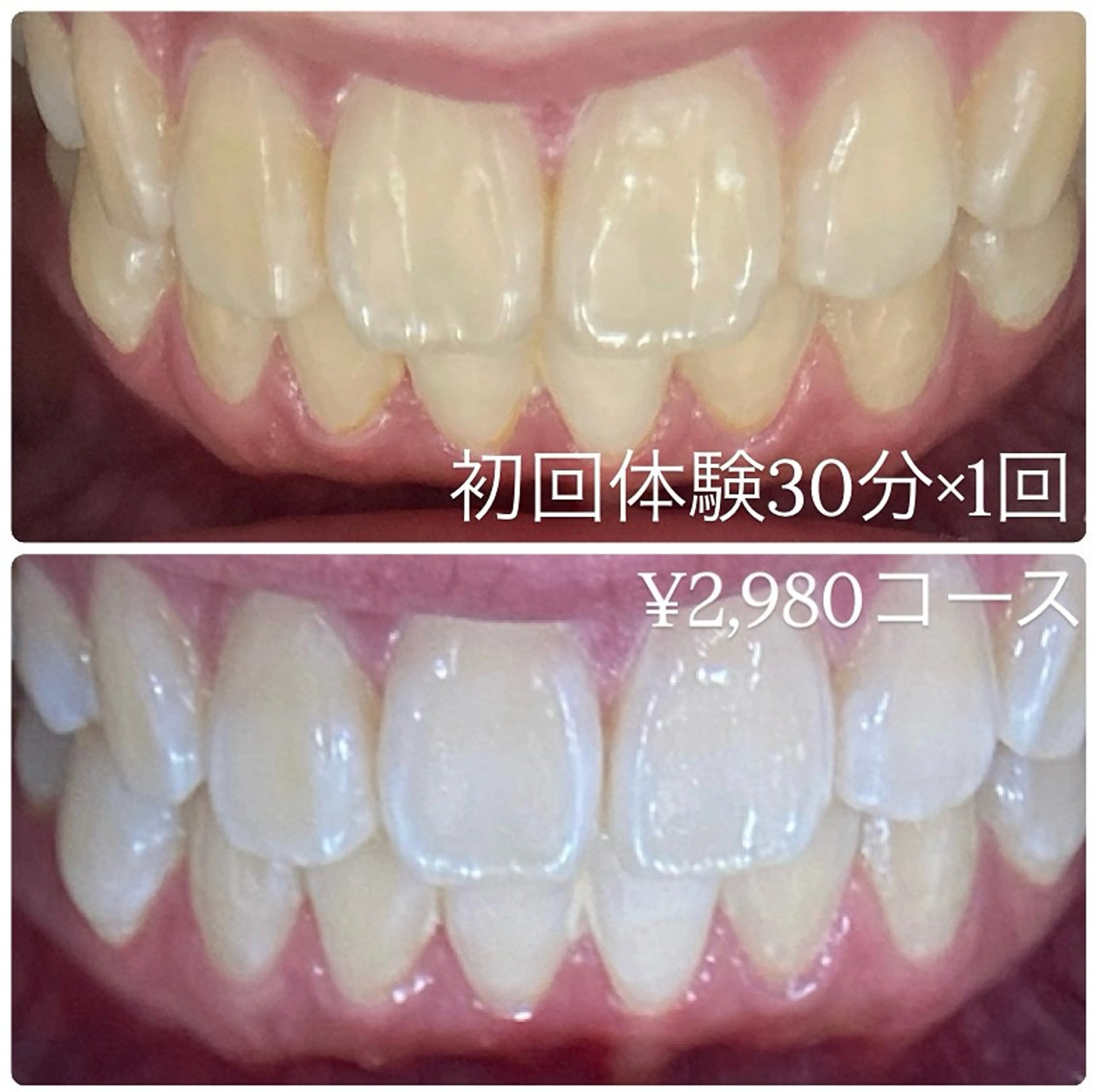 ホワイトニングルーム 横浜店のその他イメージ