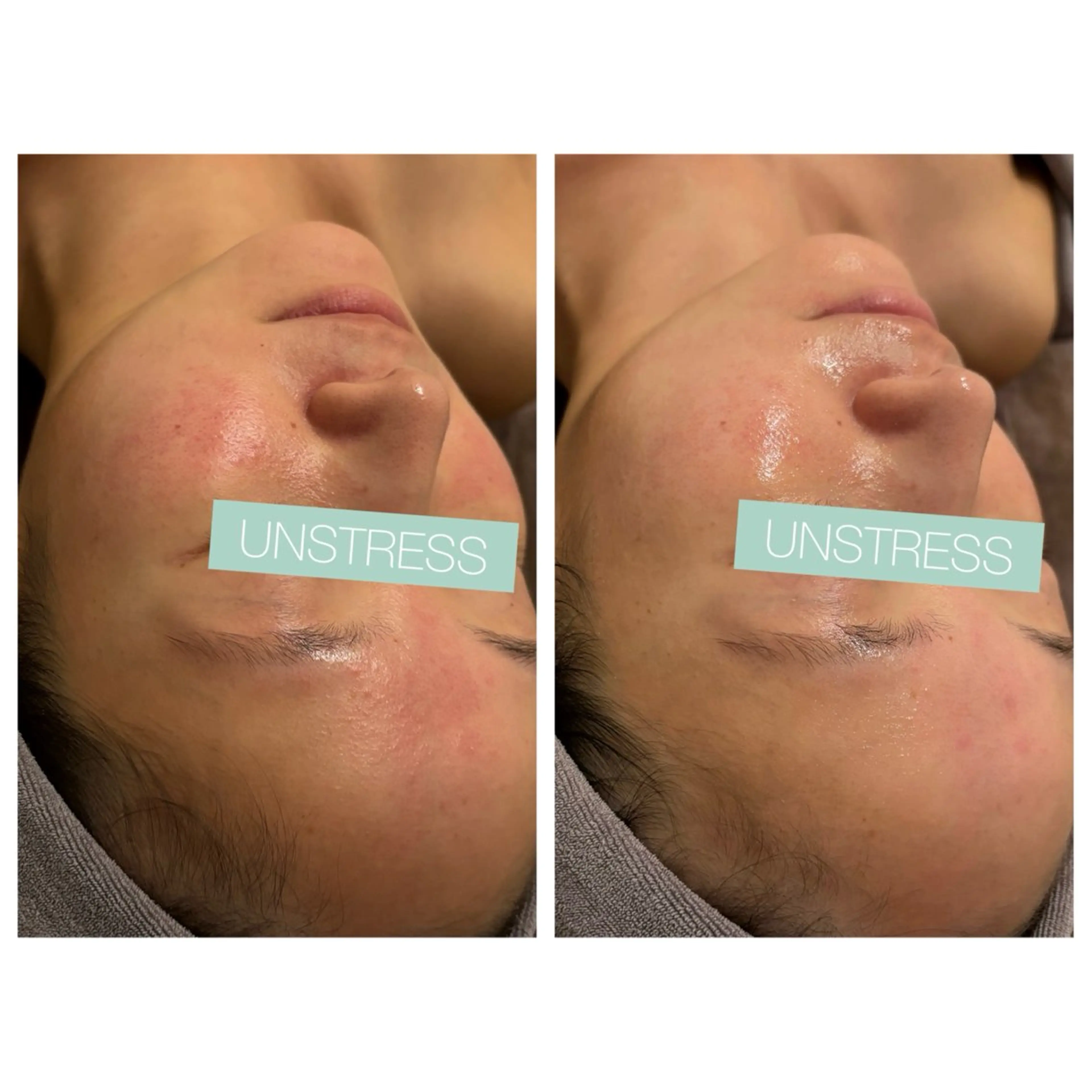 小顔コルギ ☆表参道/外苑前のエステ・リラクイメージ