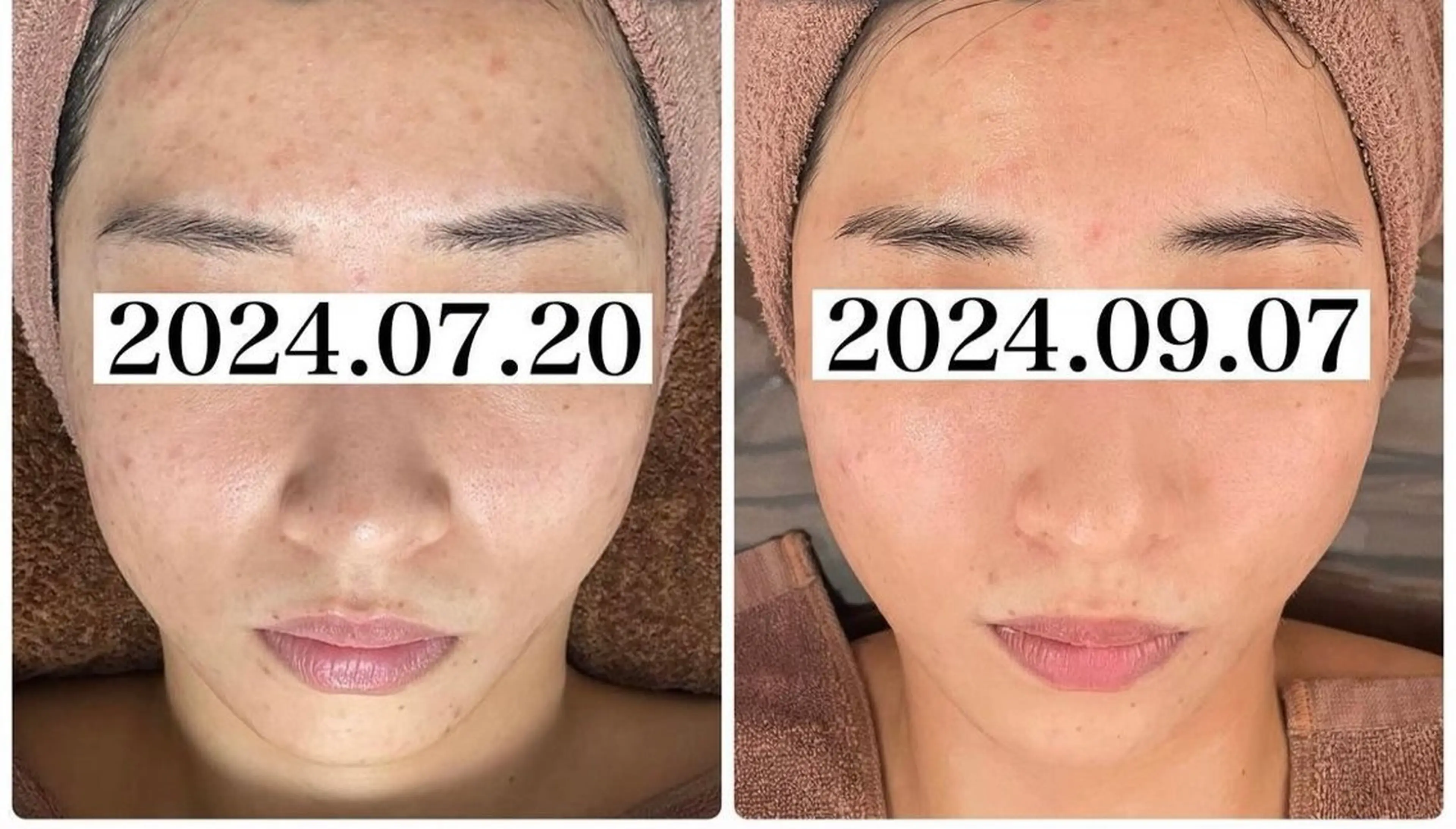 中目黒ハーブピーリン グ🌿ララピールのエステ・リラクイメージ