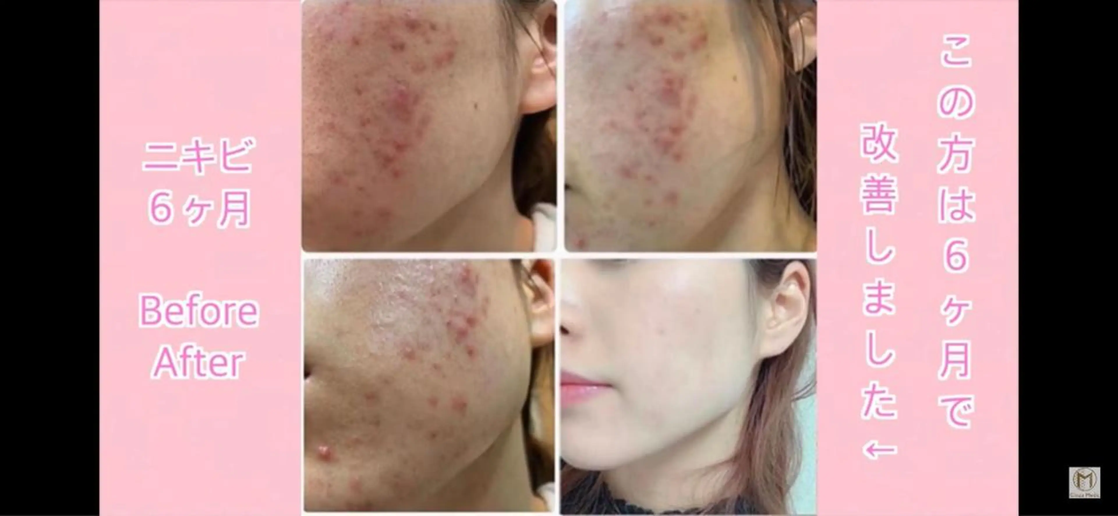 アンジュベル Ginzaのマツエク・マツパデザイン