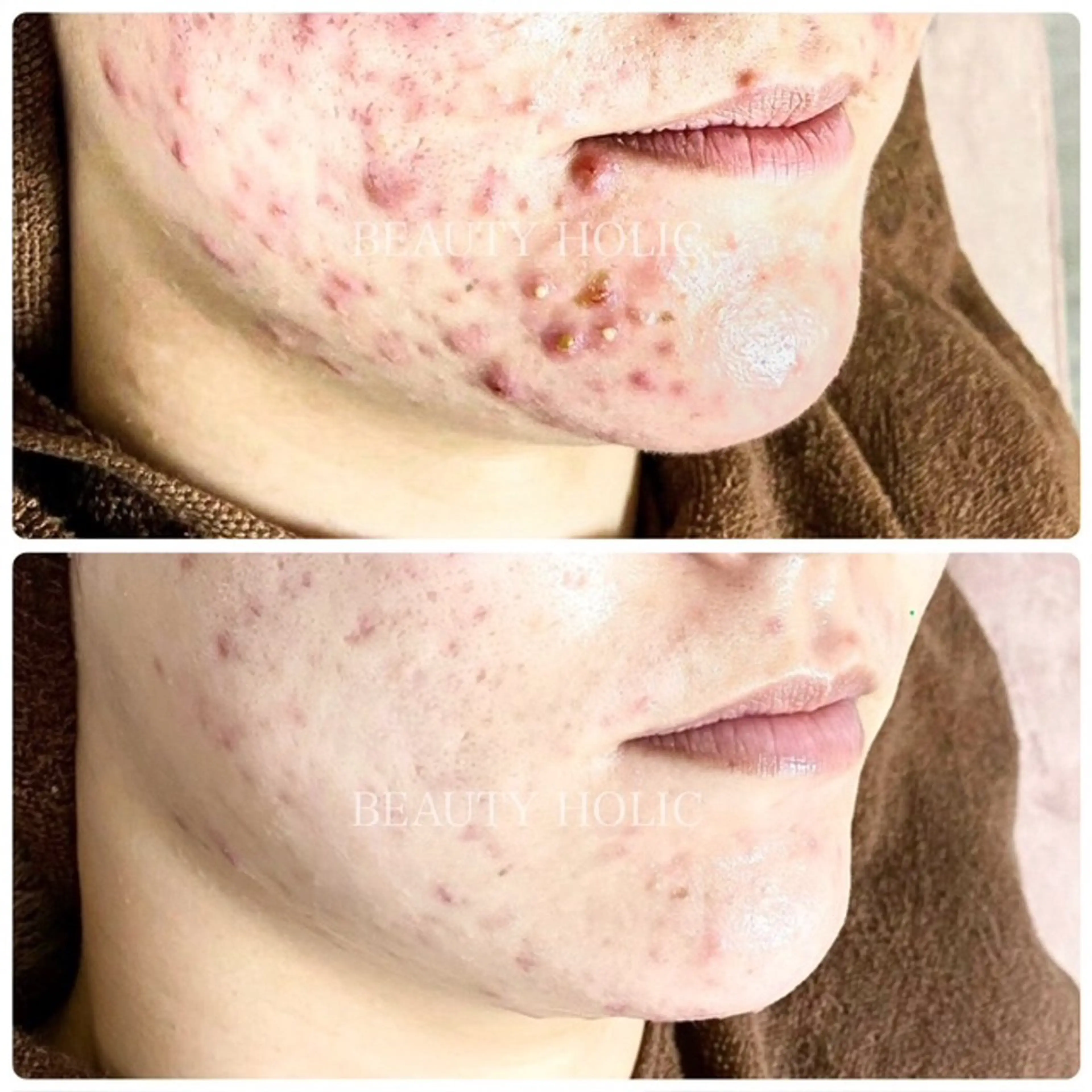 ビューティーホリック 東金店のエステ・リラクイメージ