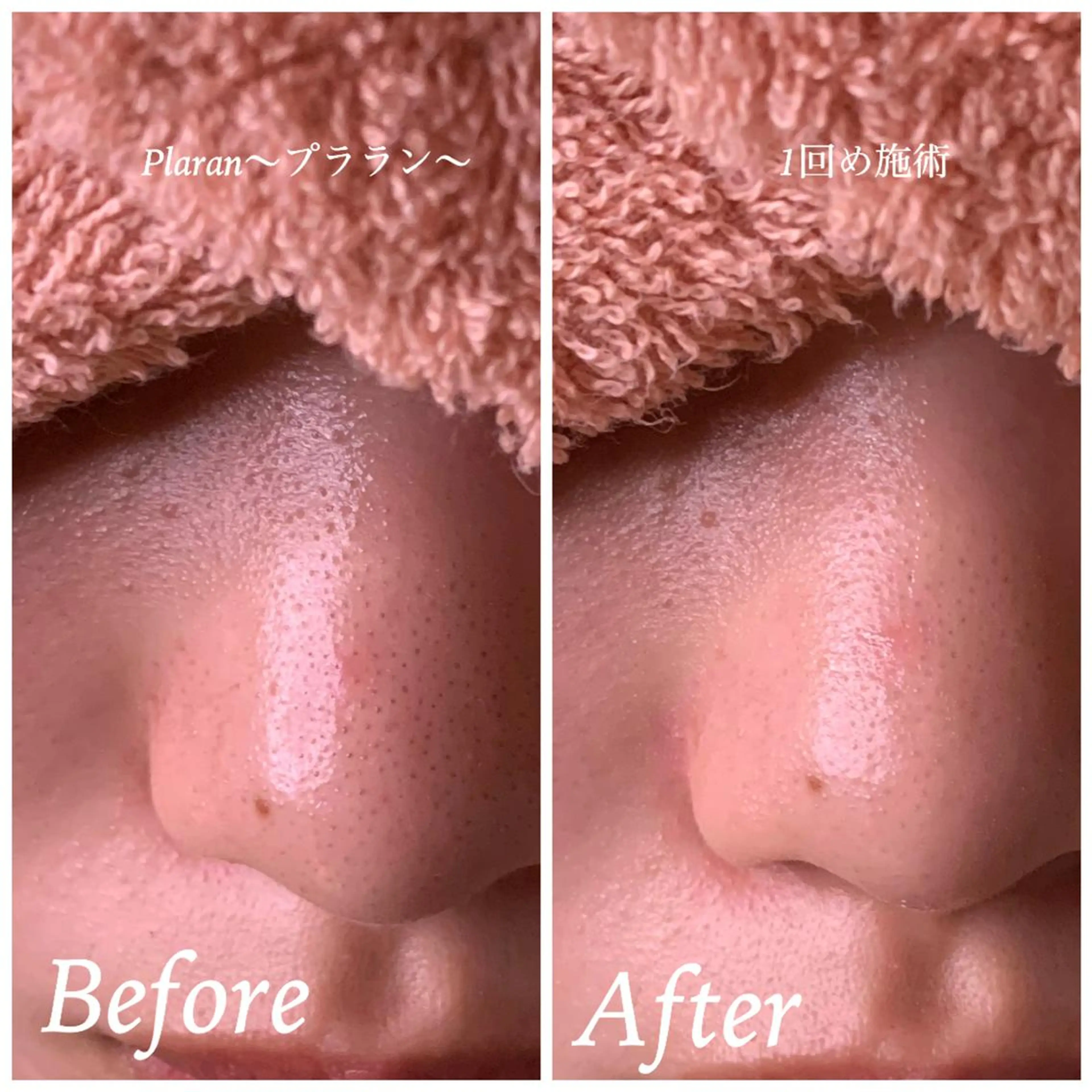 Plaran 〜プララン 〜のその他イメージ