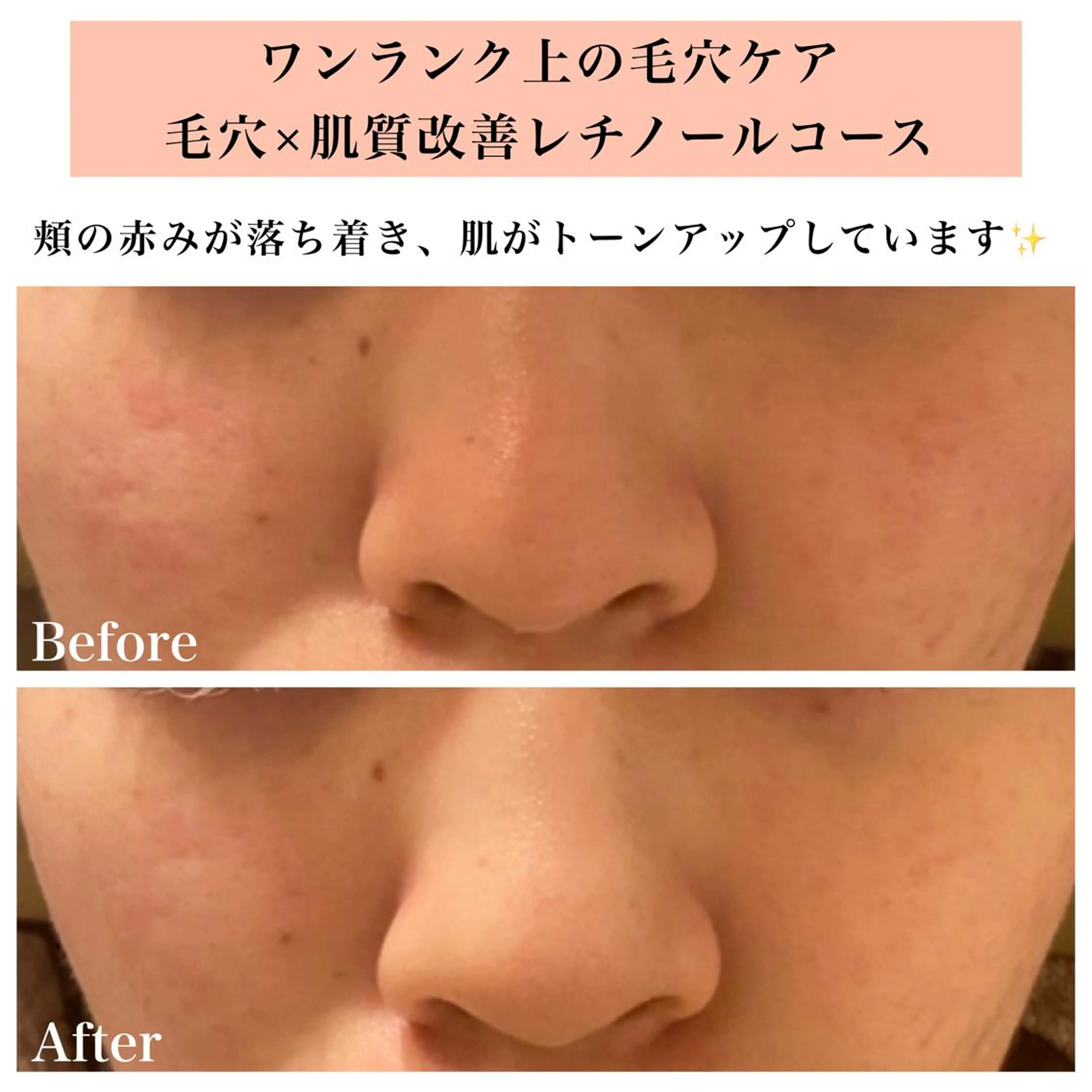 エステ リラク Bellesthe （ベルエステ）のエステ・リラクイメージ