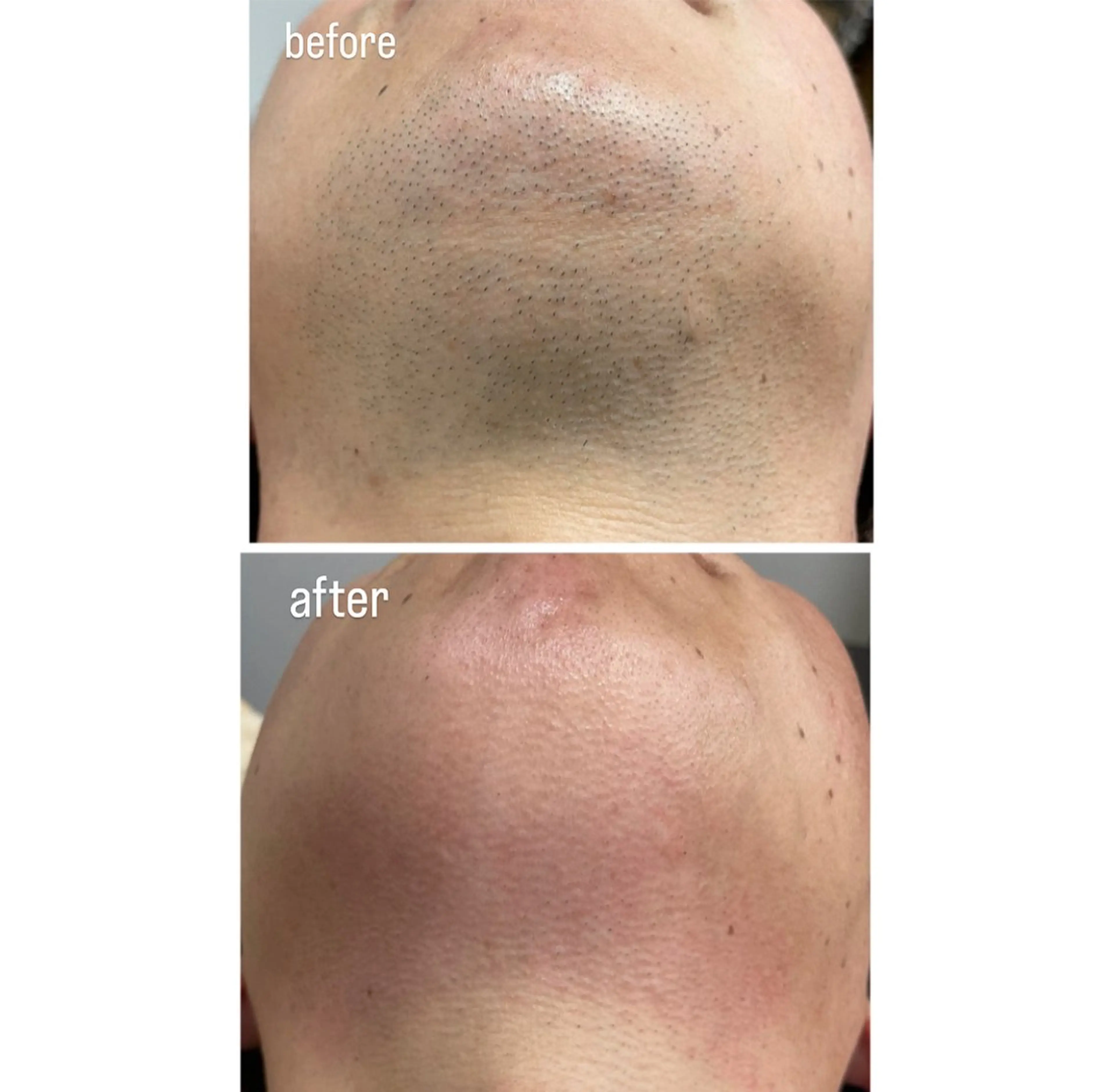 脱毛 DISINI  SPA所属・DISINISPA 脱毛/フェイシャルのエステ・リラクイメージ