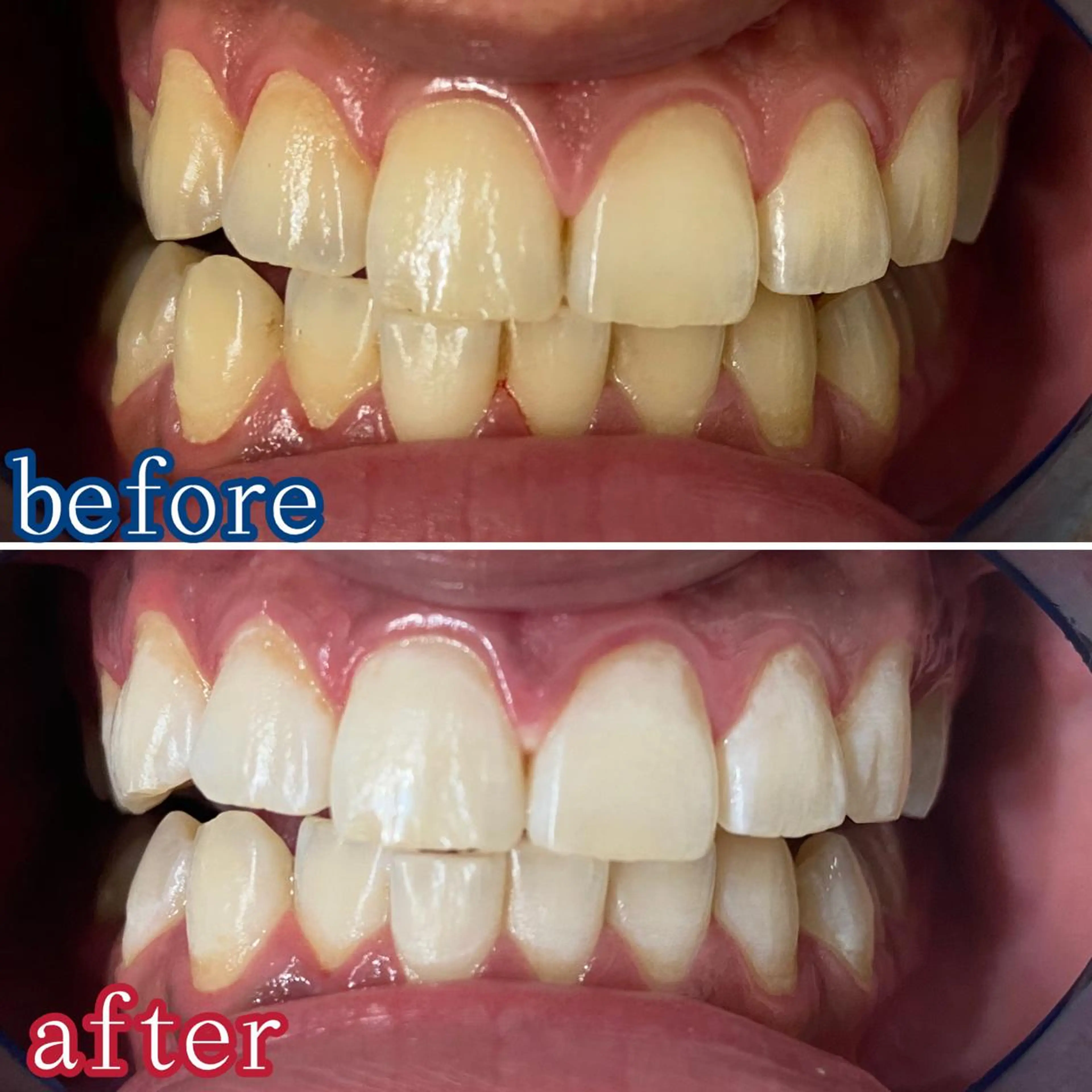 メンズ その他 ホワイトニングサロン CREWのその他イメージ