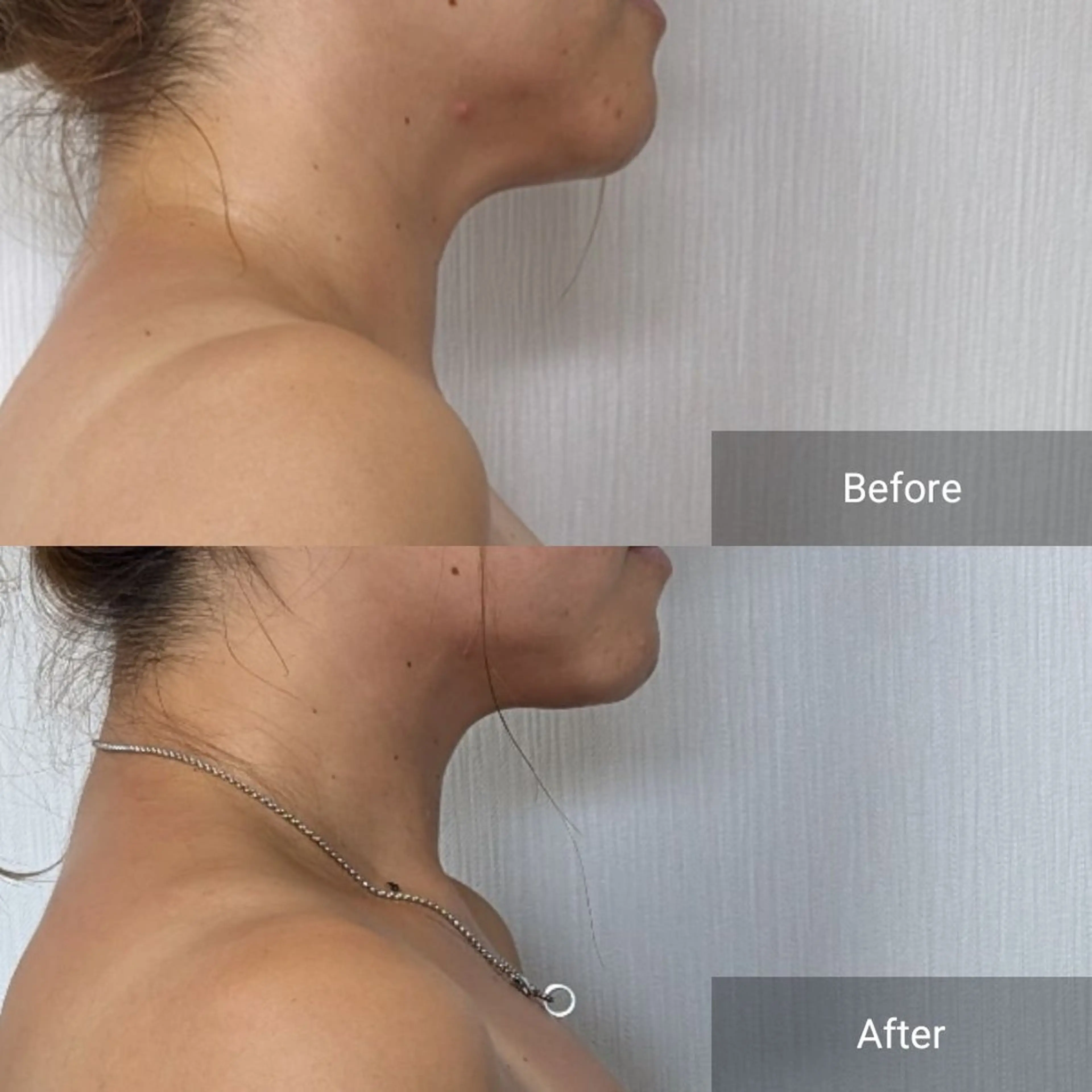 エステ nail RiRi アトレナチュラのエステ・リラクイメージ