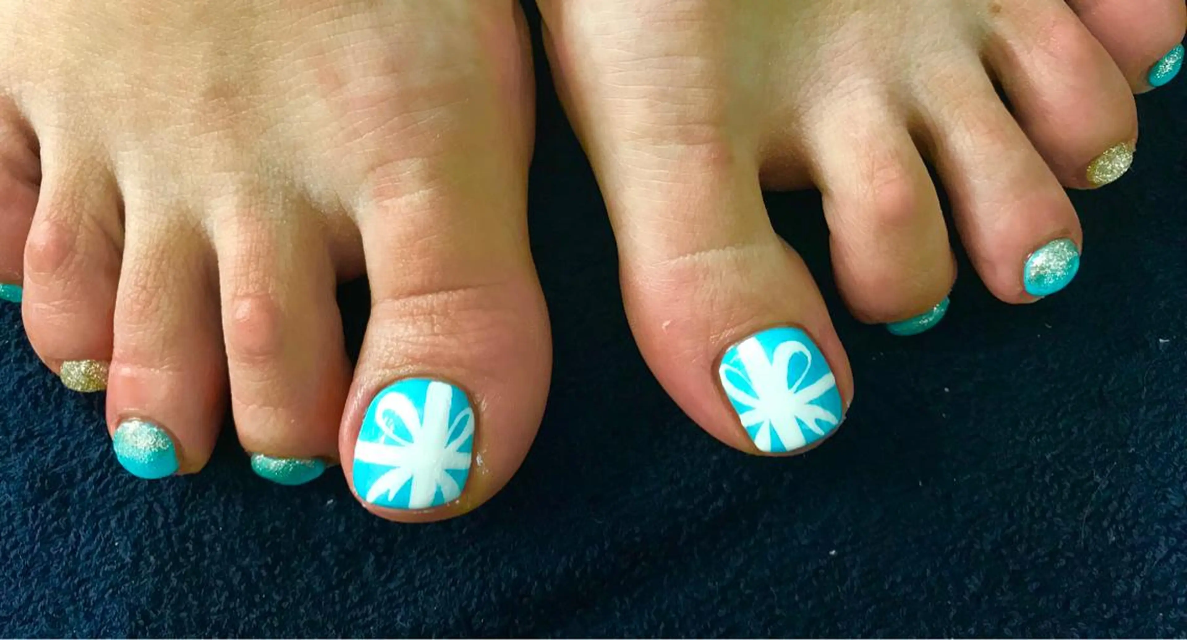 ネイル フットネイル Charme. NOBUKOのネイルデザイン