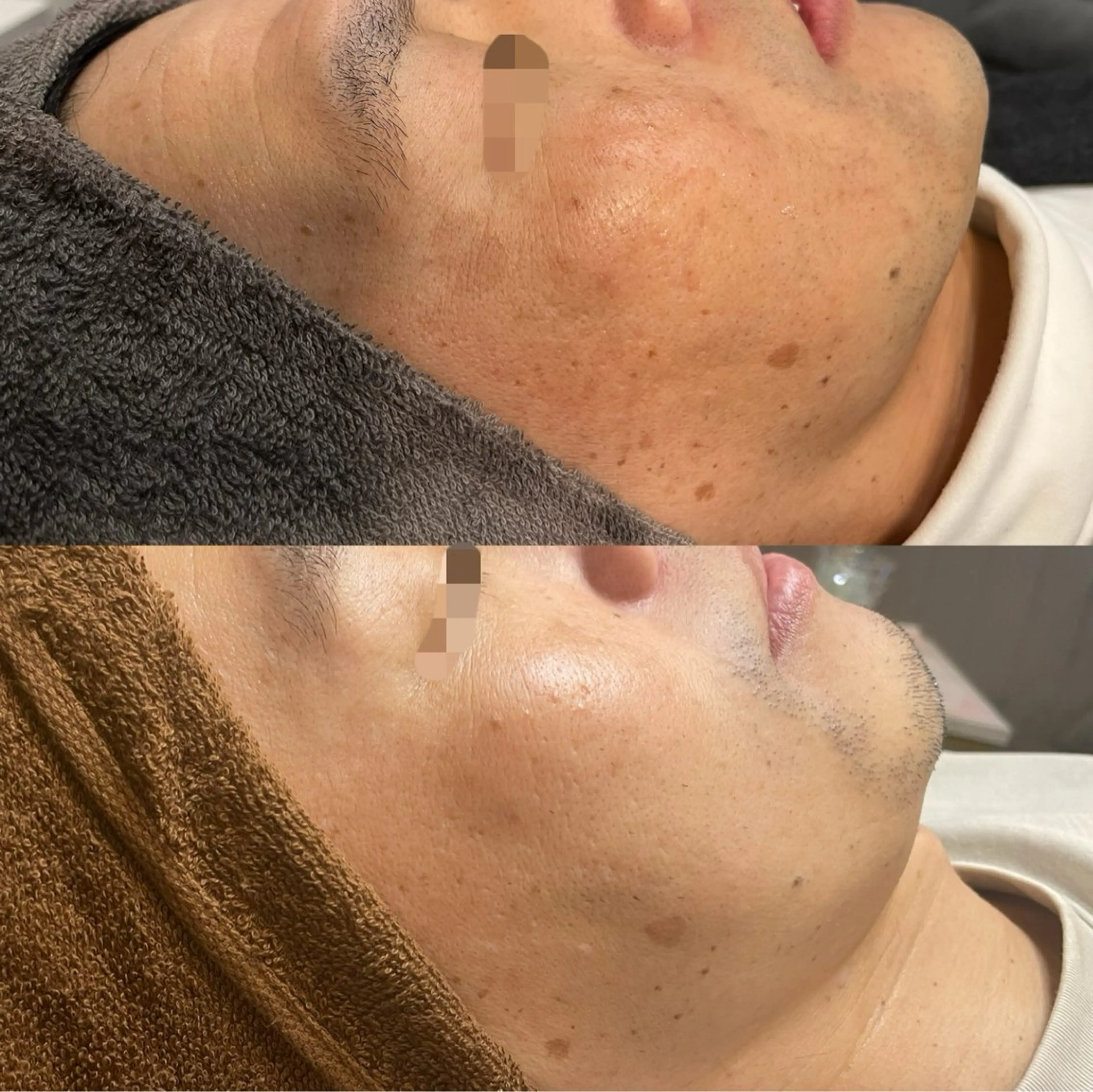 シミケア専門店 モルセラのエステ・リラクイメージ