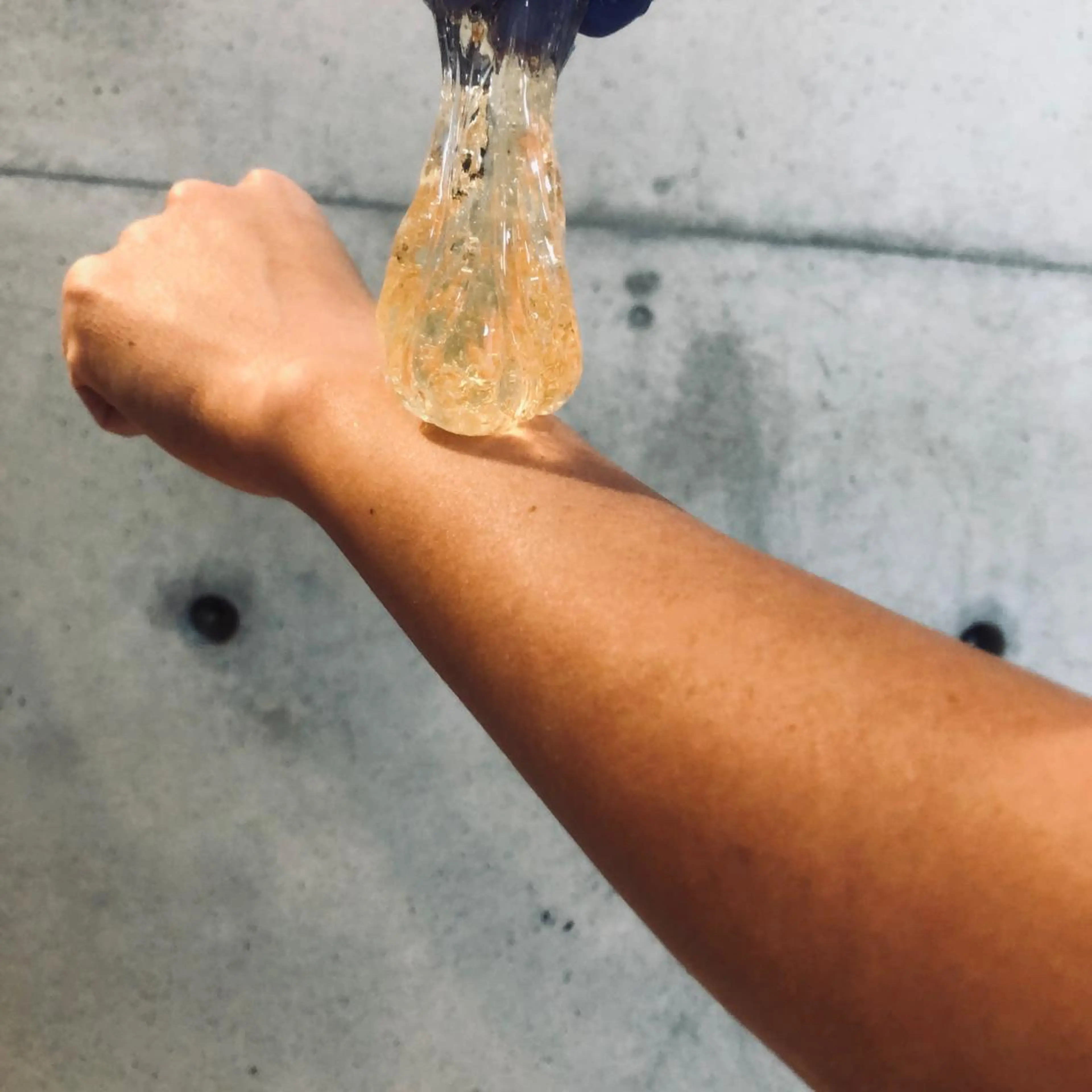 ひじ下✴︎シュガーリング脱毛の写真