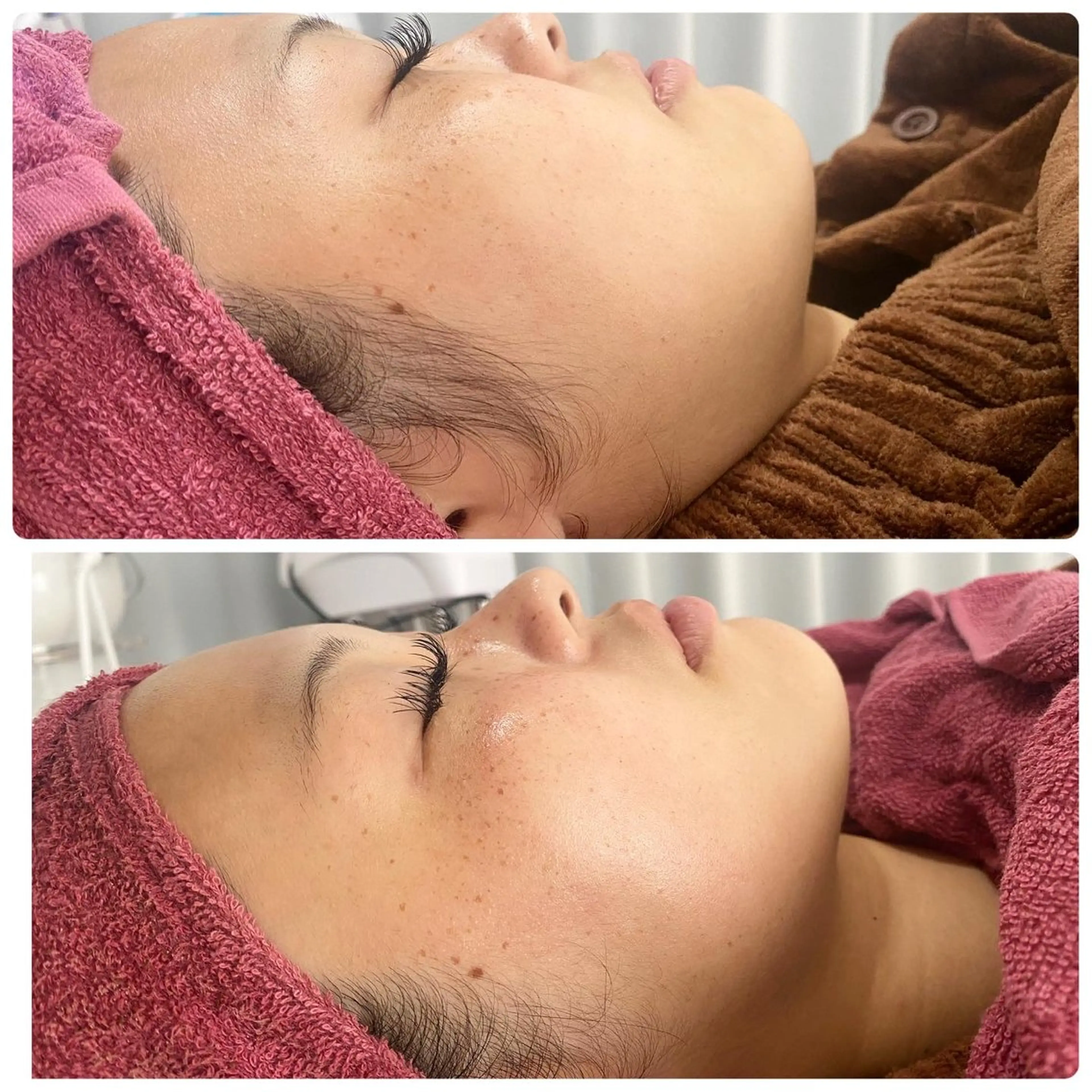 エステ REVI取扱・肌悩み 毛穴Chalonのエステ・リラクイメージ