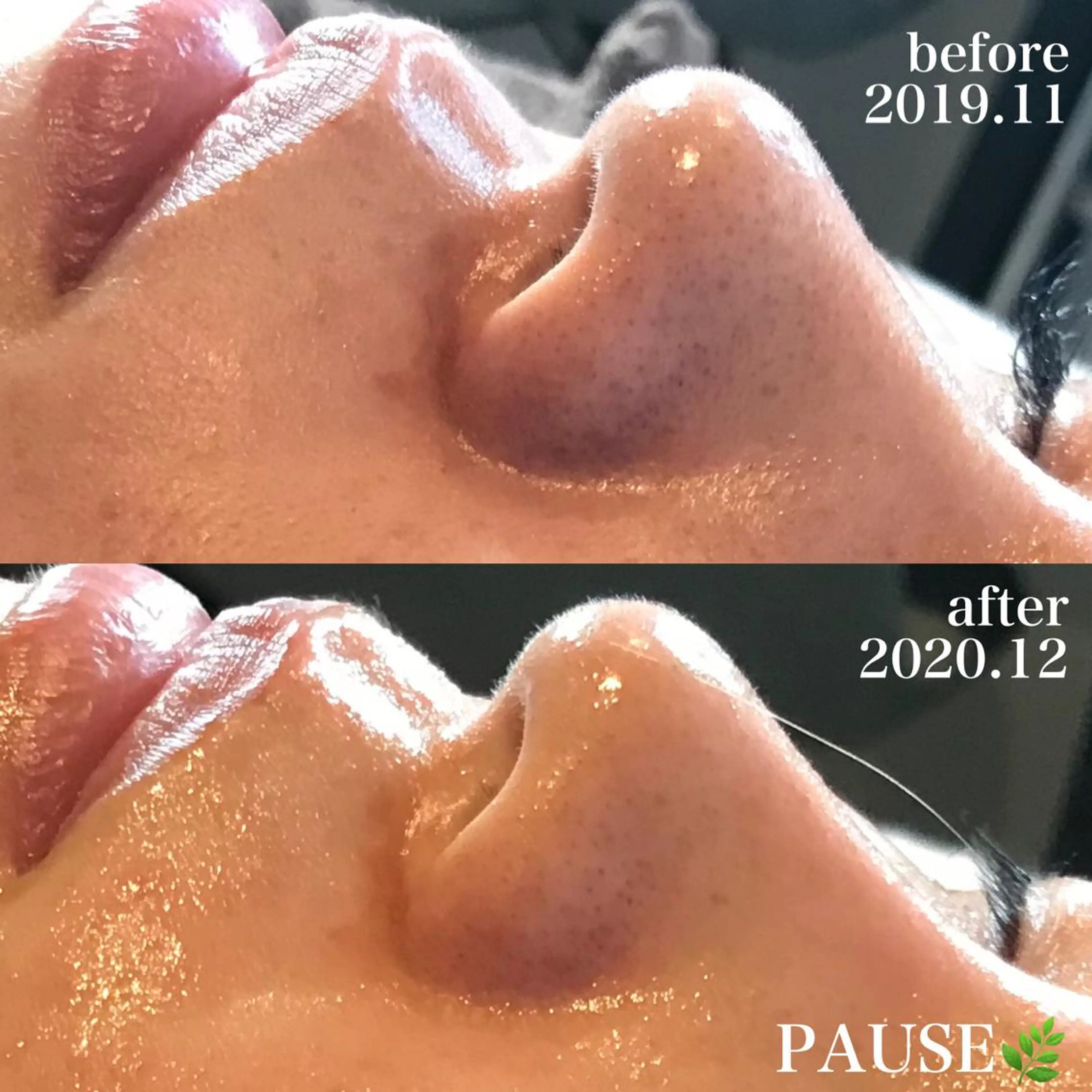 エステ 浜野 恵美のエステ・リラクイメージ