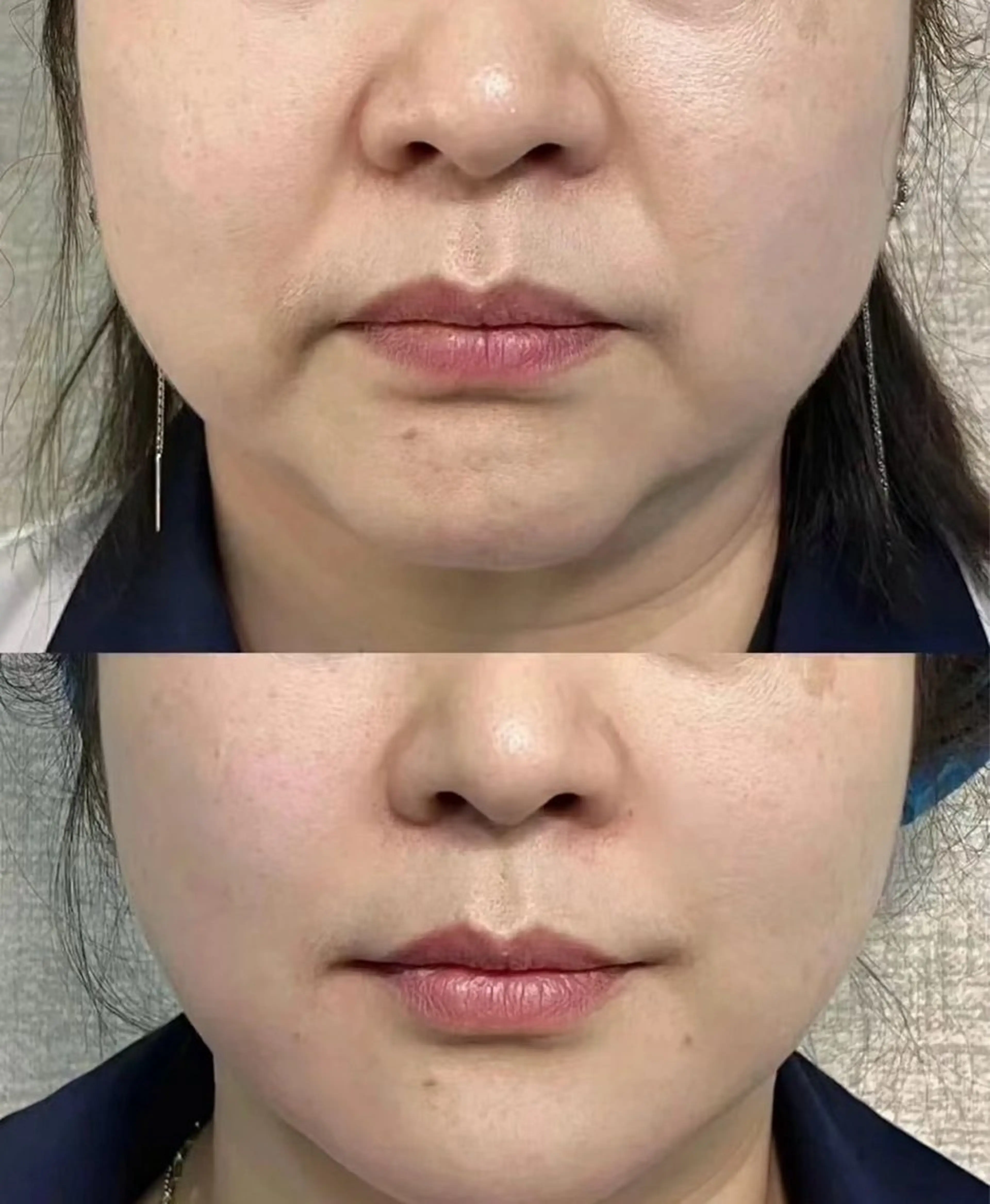 マツエク・マツパ エステ リラク 愛維美水光美肌専門店 メンズレディースokのエステ・リラクイメージ