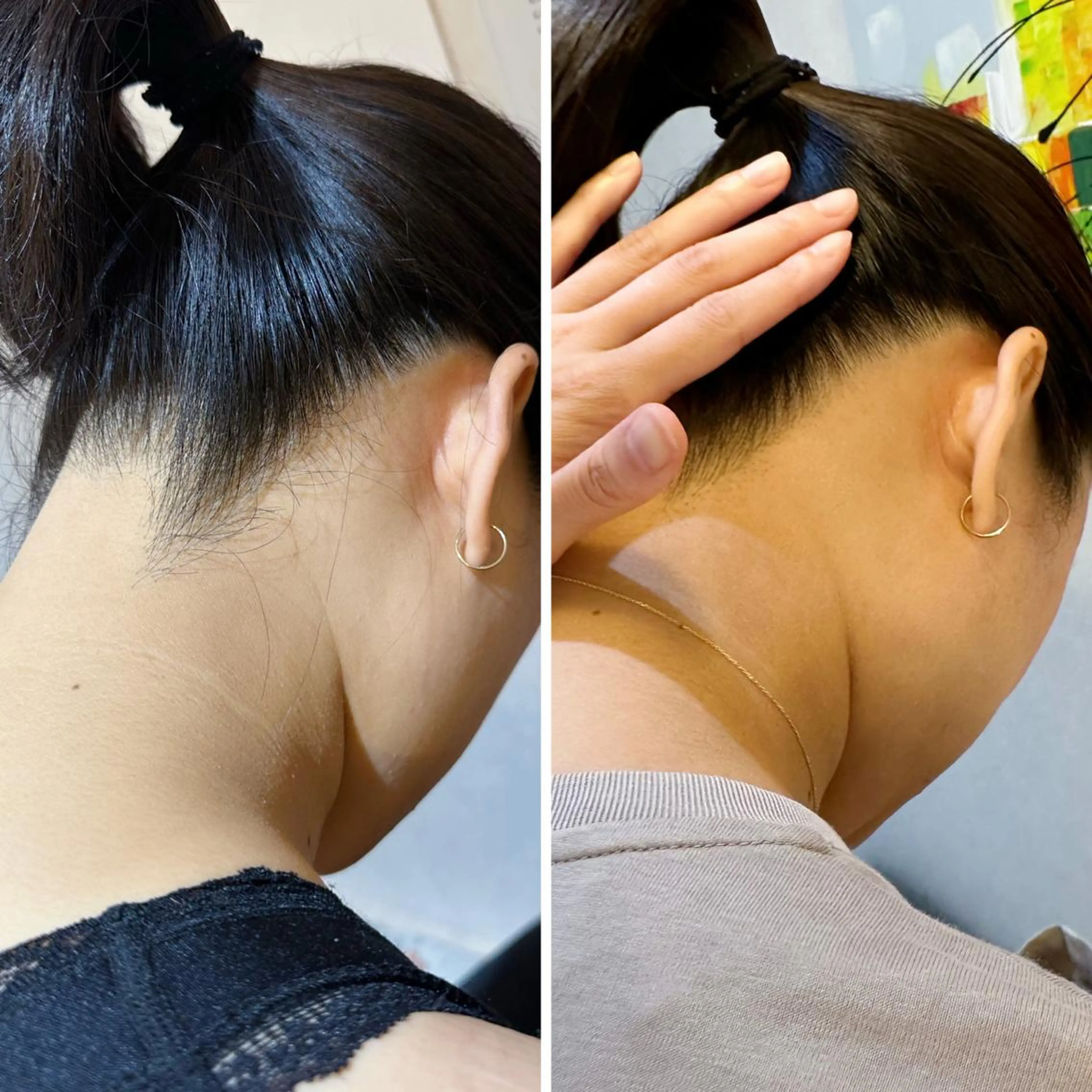 うなじ脱毛/美肌脱毛 LABELのエステ・リラクイメージ