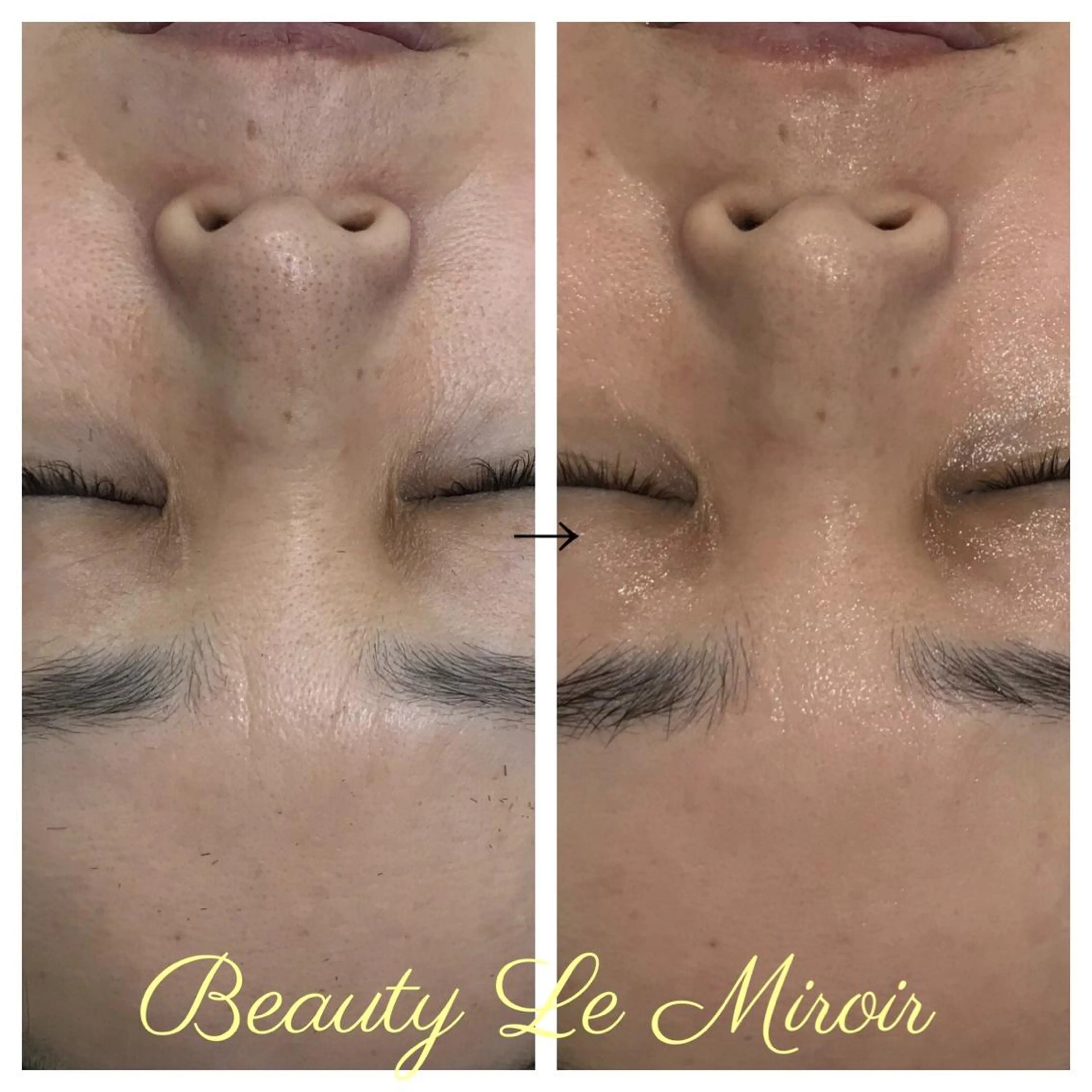 マツエク・マツパ ビューティー ミロワールのエステ・リラクイメージ