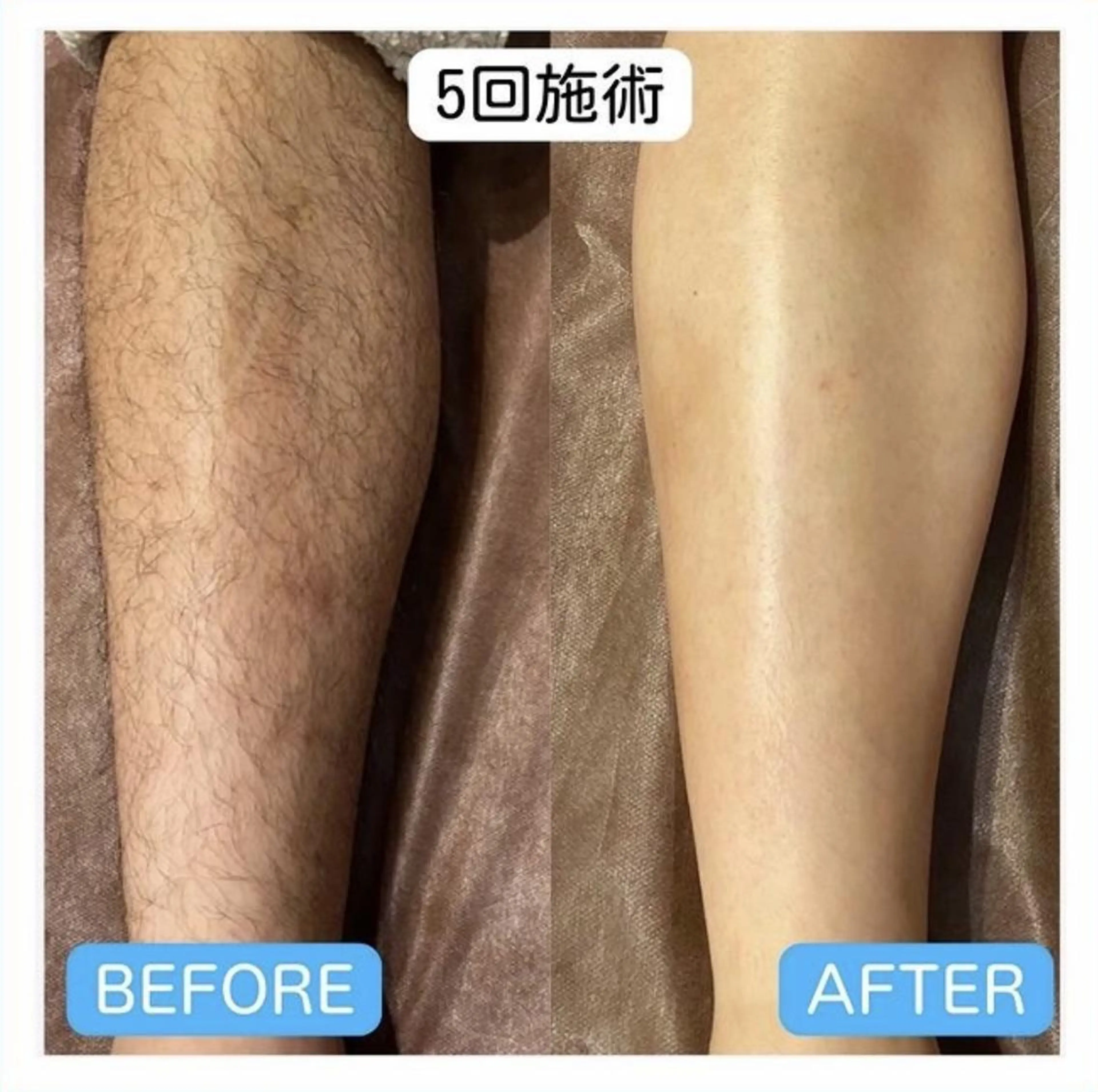 【天神・大名】脱毛/ ハーブ植松७९०のエステ・リラクイメージ