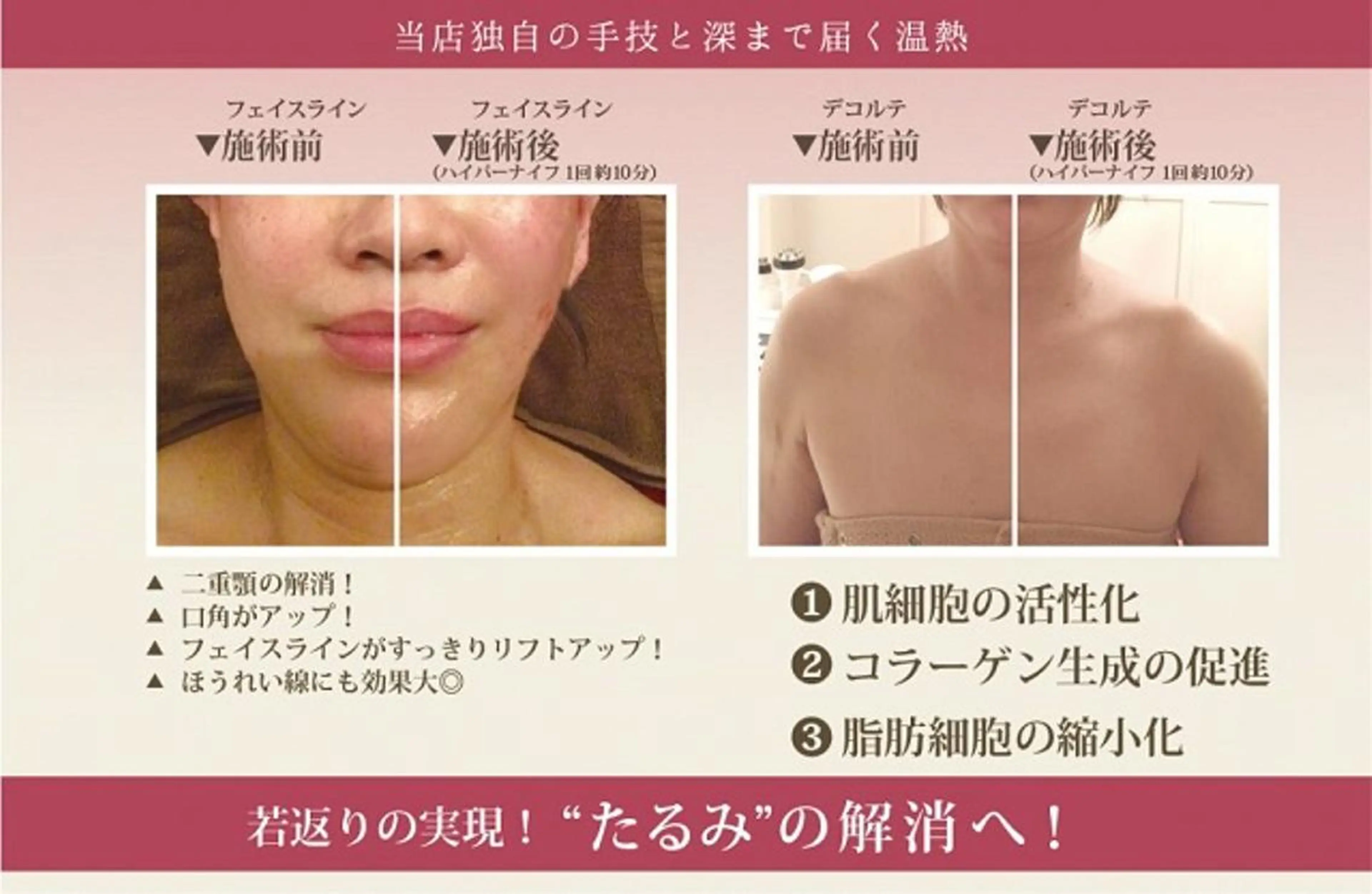 カラー ネイル マツエク・マツパ 小顔矯正・美容鍼 美鍼堂のエステ・リラクイメージ