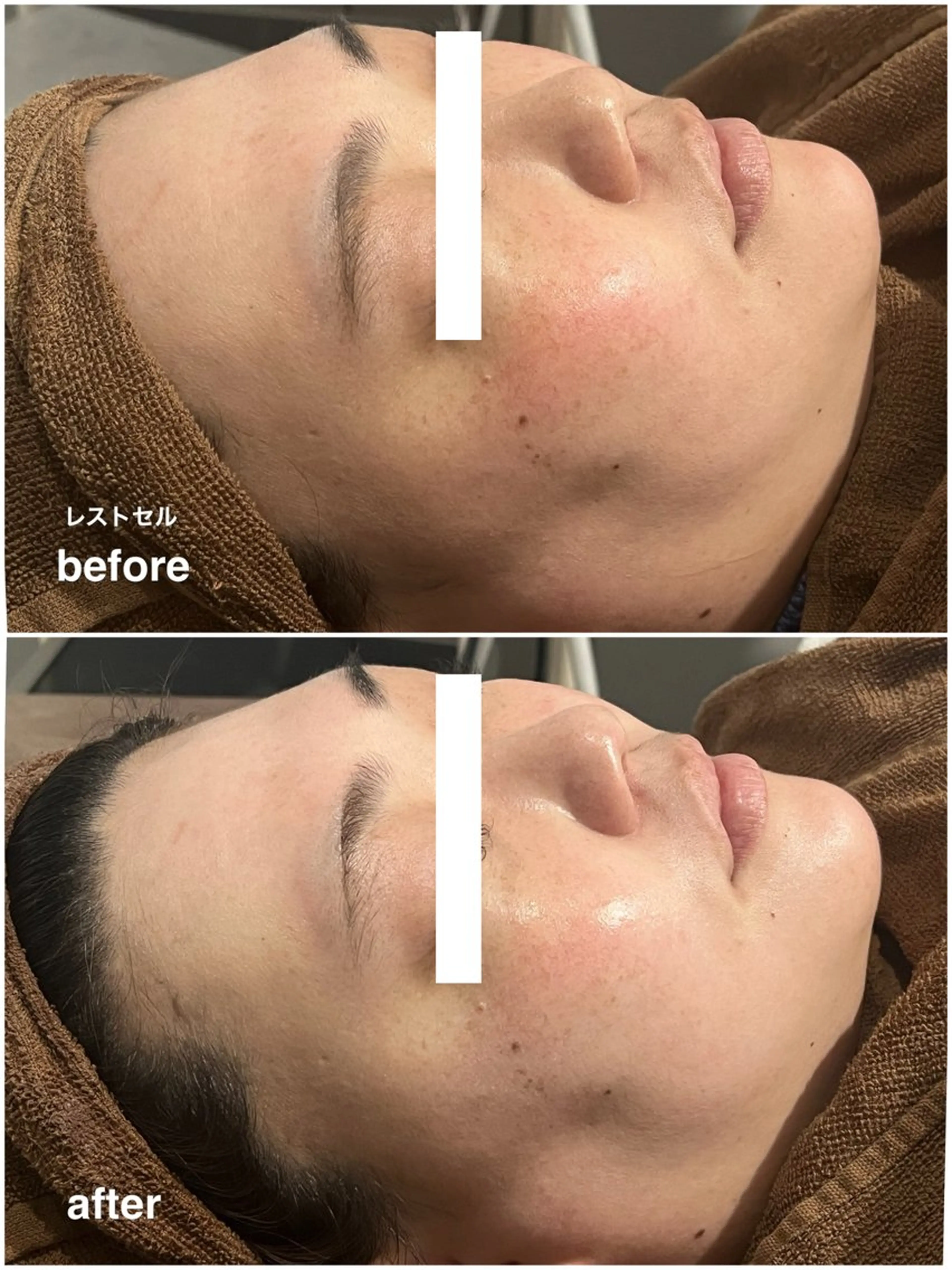 ENCHANT Kaede/肌質改善のその他イメージ