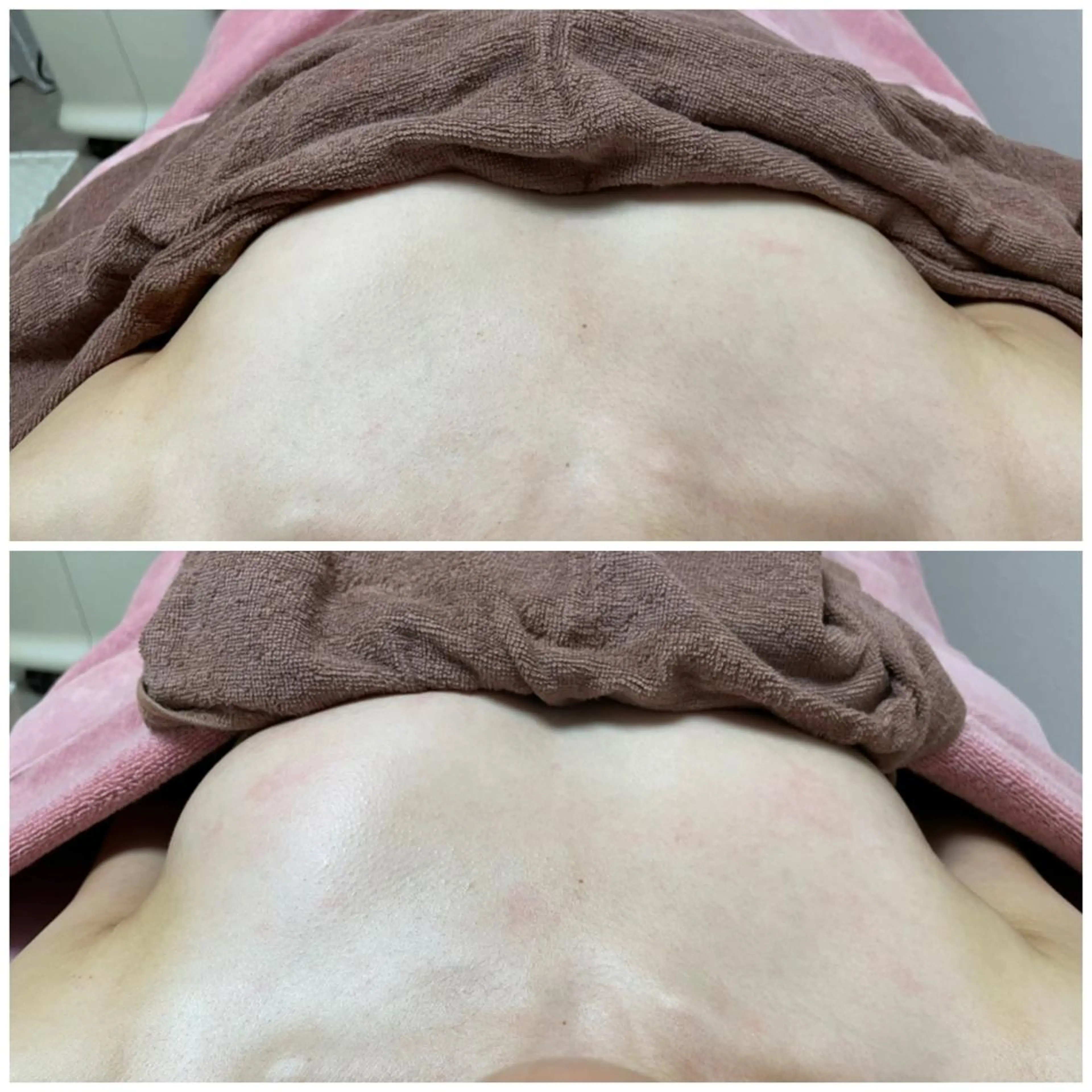 Linomalie エステ/たるみ/脱毛のエステ・リラクイメージ