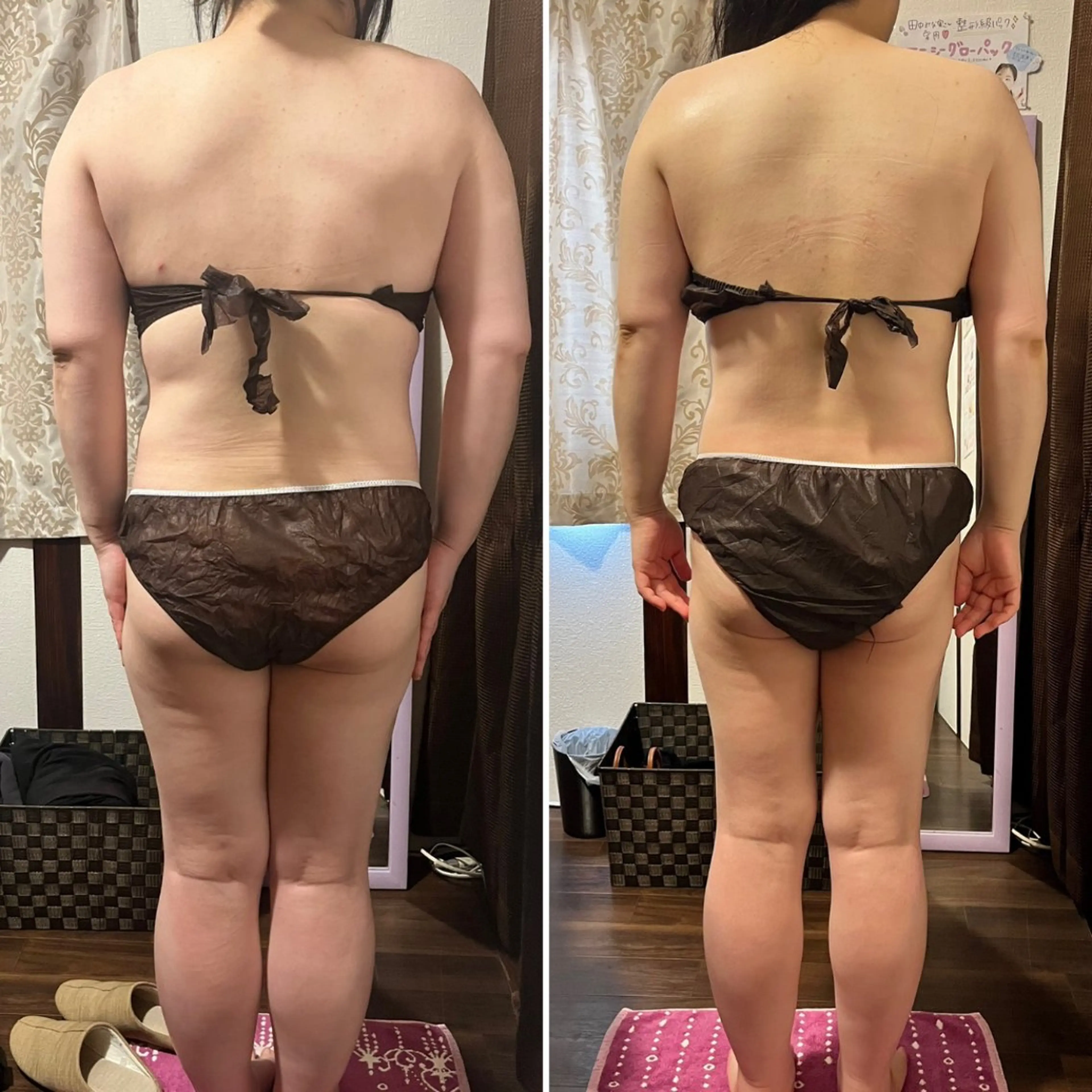 シミ・毛穴ケア専門 クロヌYUKIのエステ・リラクイメージ