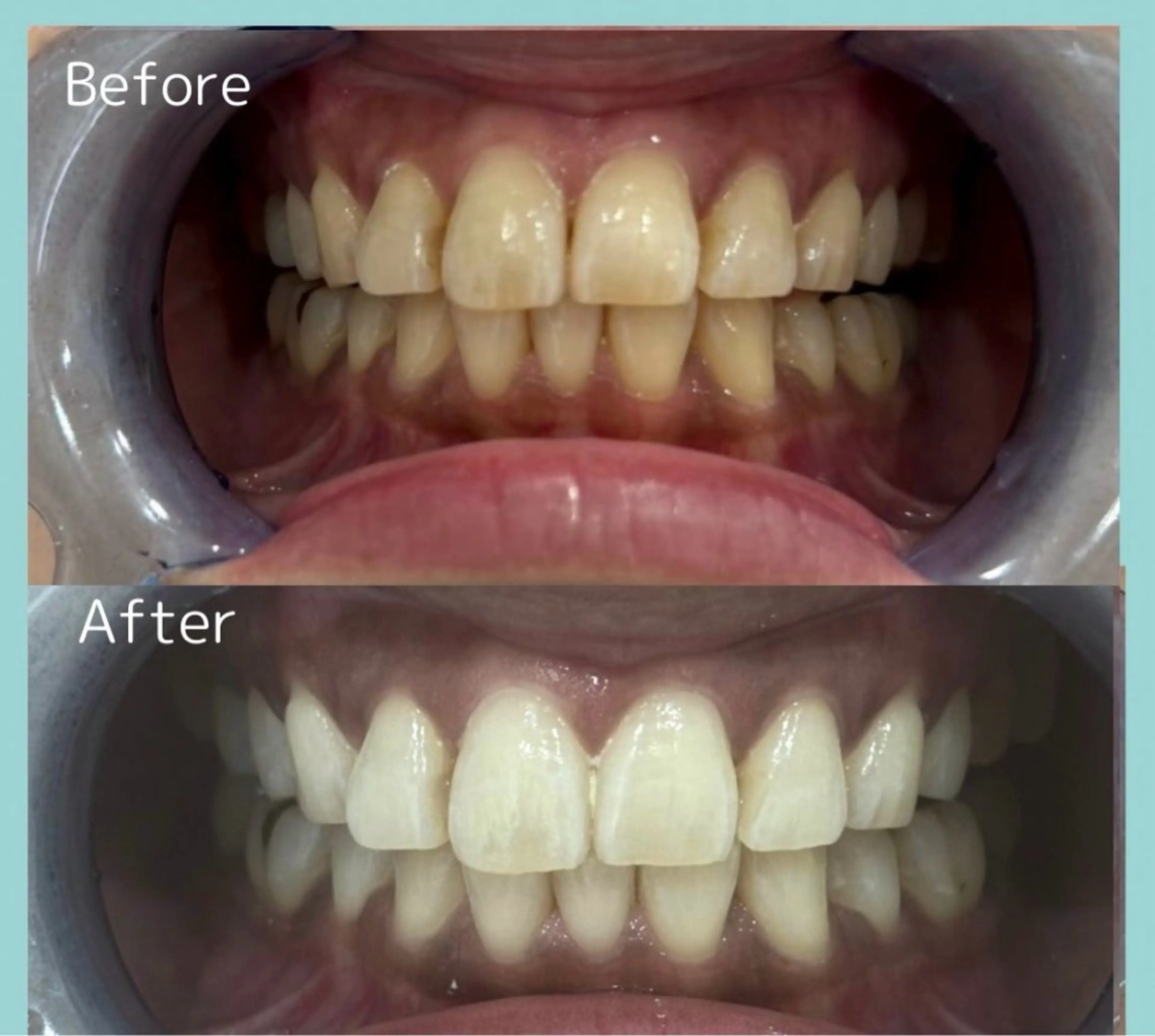 TWINKLE上尾店 Shimadaのエステ・リラクイメージ