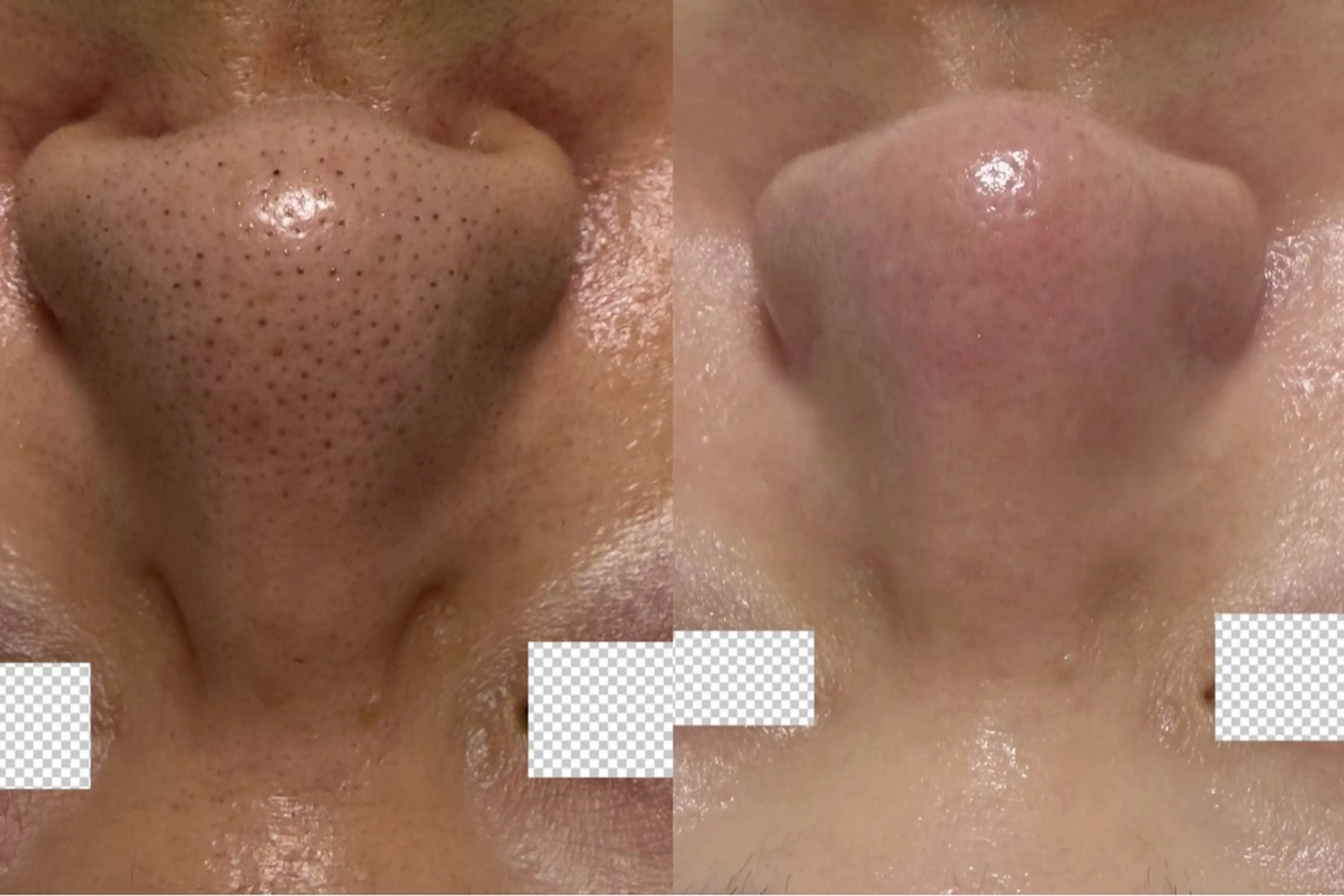 その他 Nature Souce毛穴専門店のその他イメージ