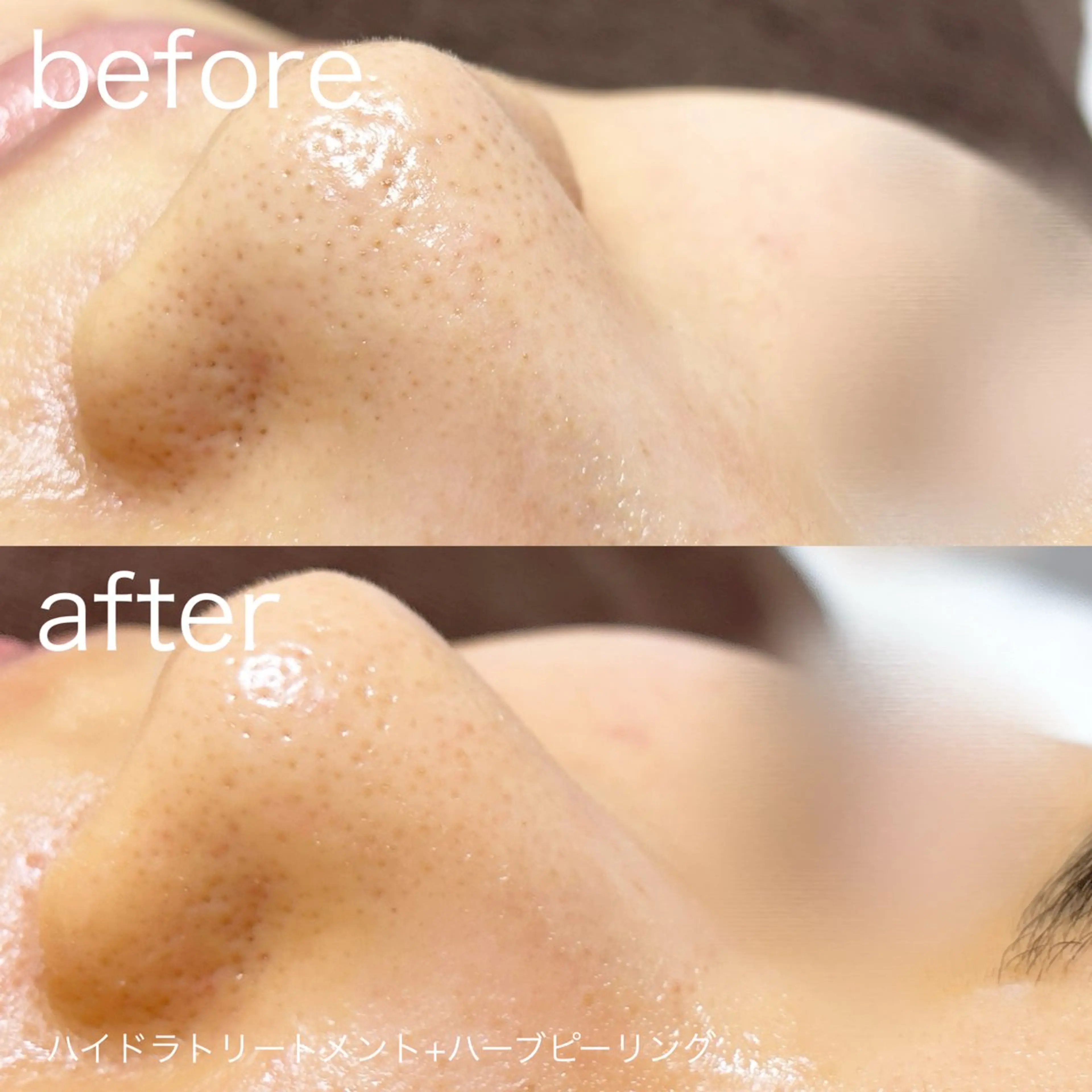 その他 lulularico Yuのエステ・リラクイメージ