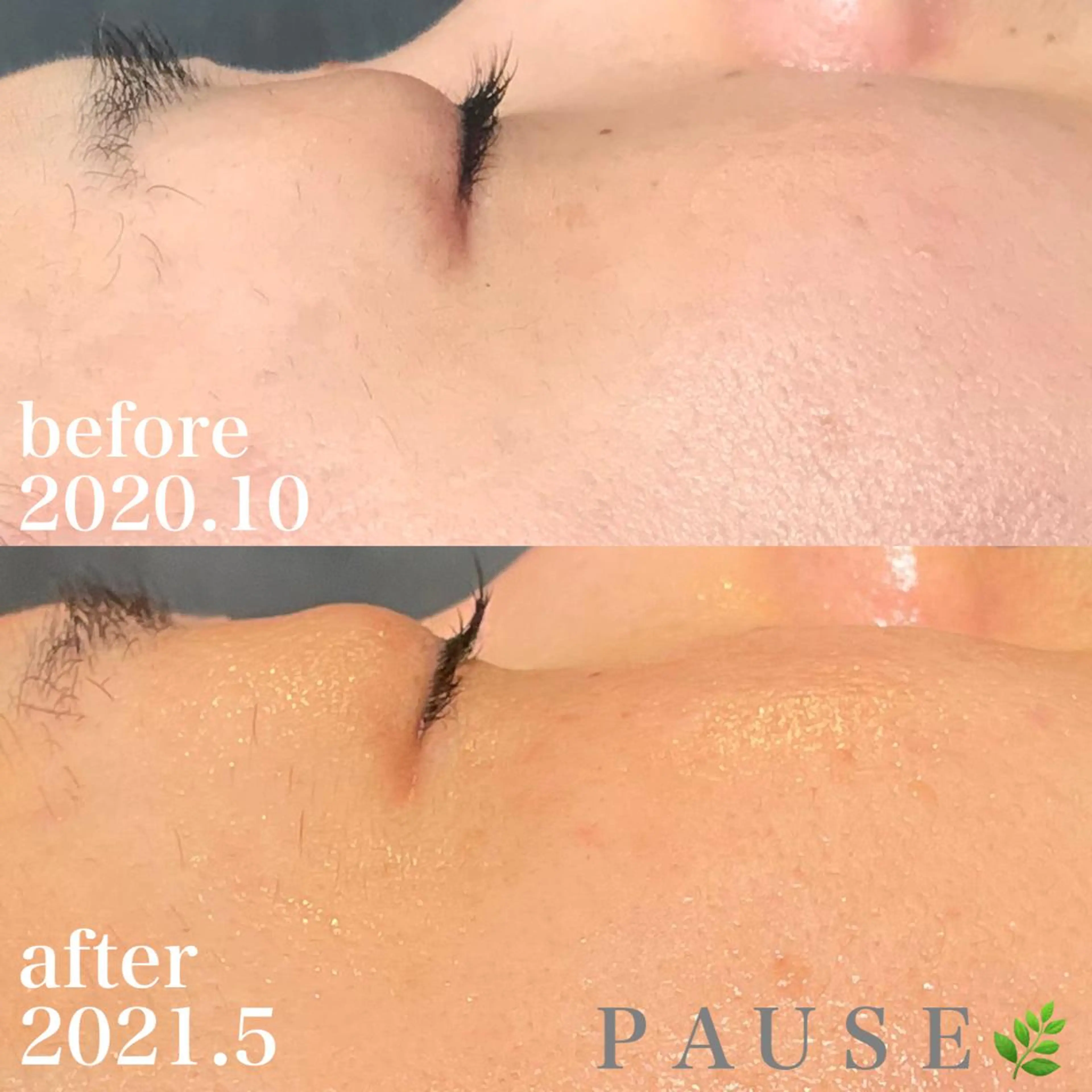 エステ 浜野 恵美のエステ・リラクイメージ