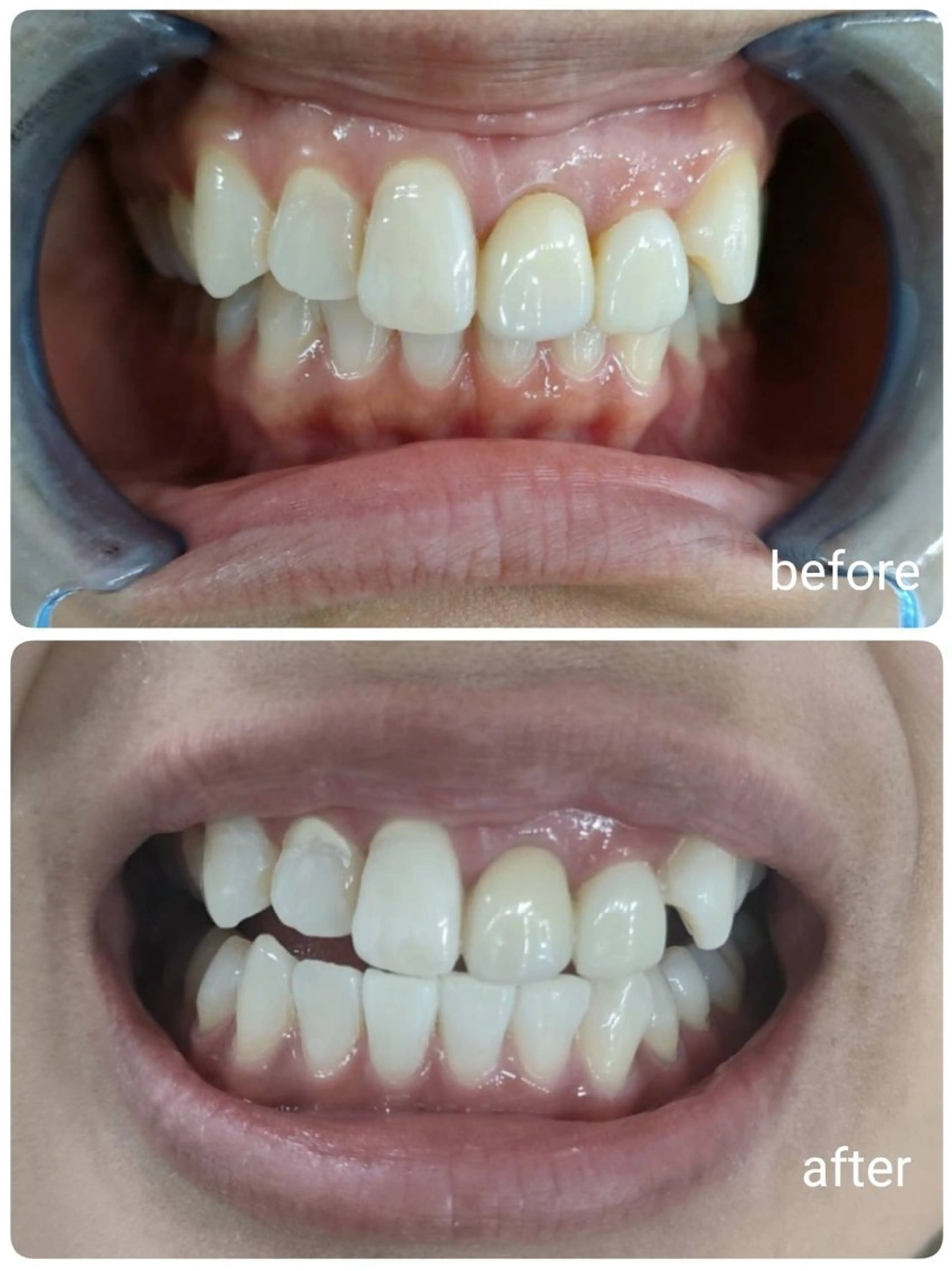 ecxia  white 　広島袋町店所属・セルフホワイトニング エクシア広島袋町店のその他イメージ