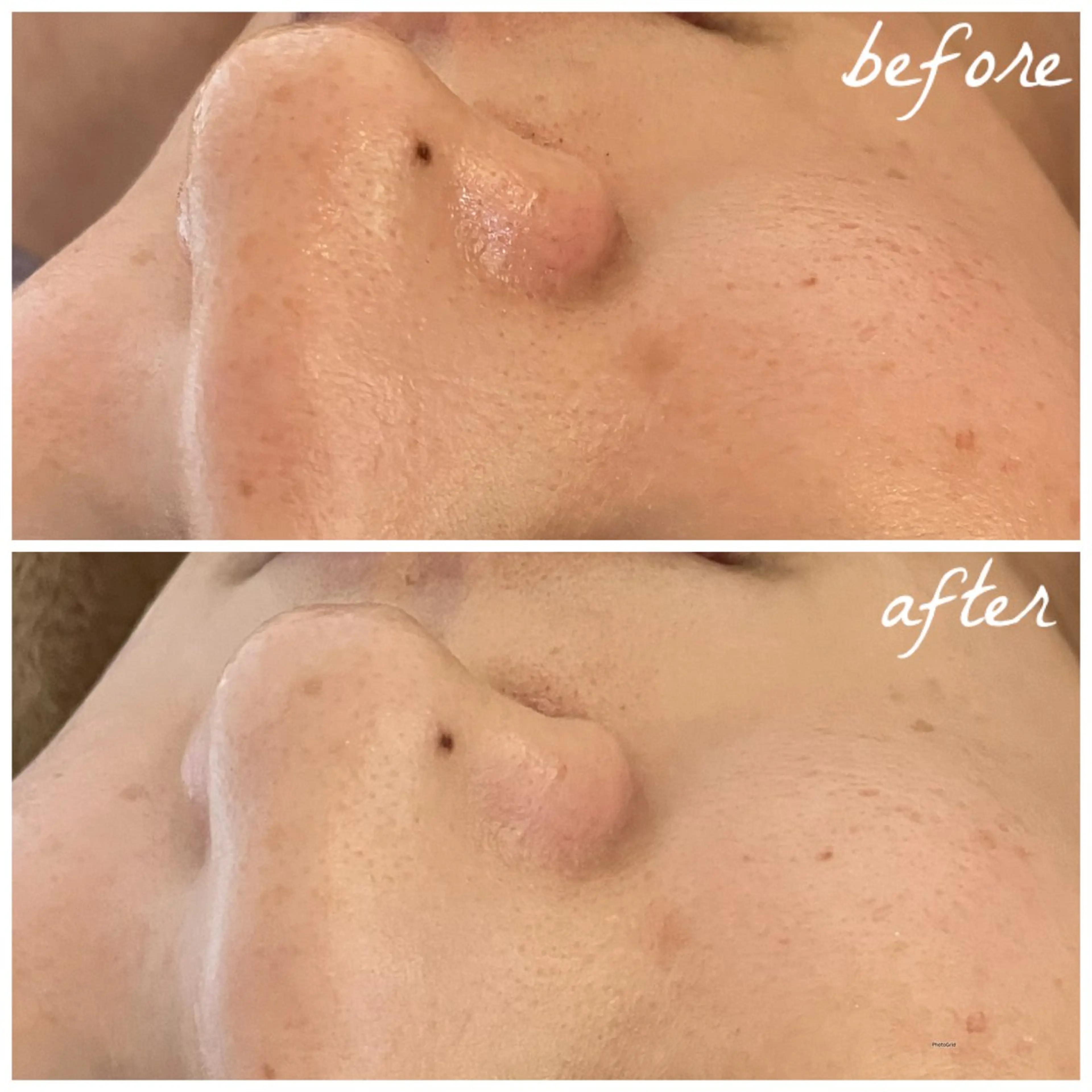 メンズ メナード岐阜茜部 杉浦のエステ・リラクイメージ