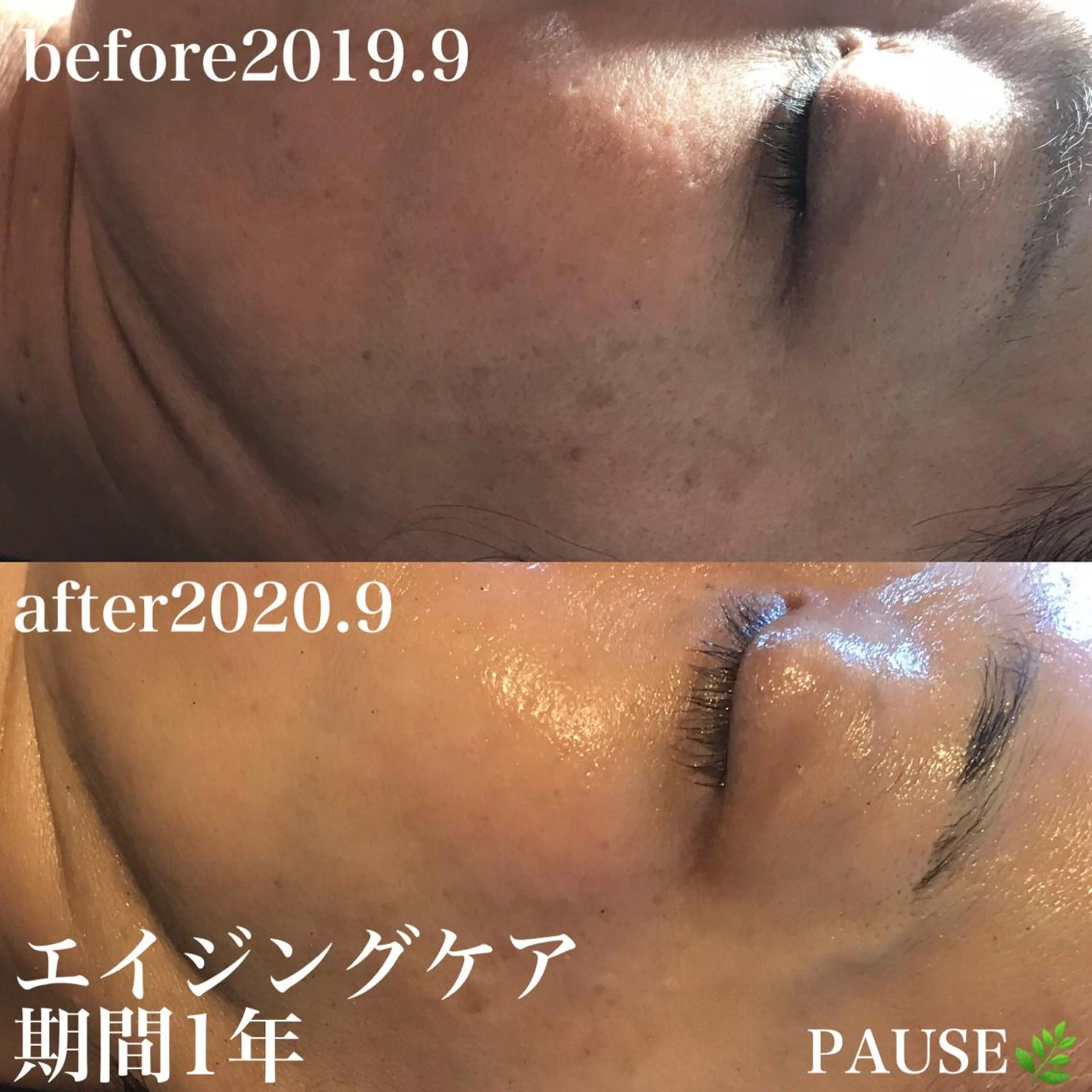 エステ 浜野 恵美のエステ・リラクイメージ