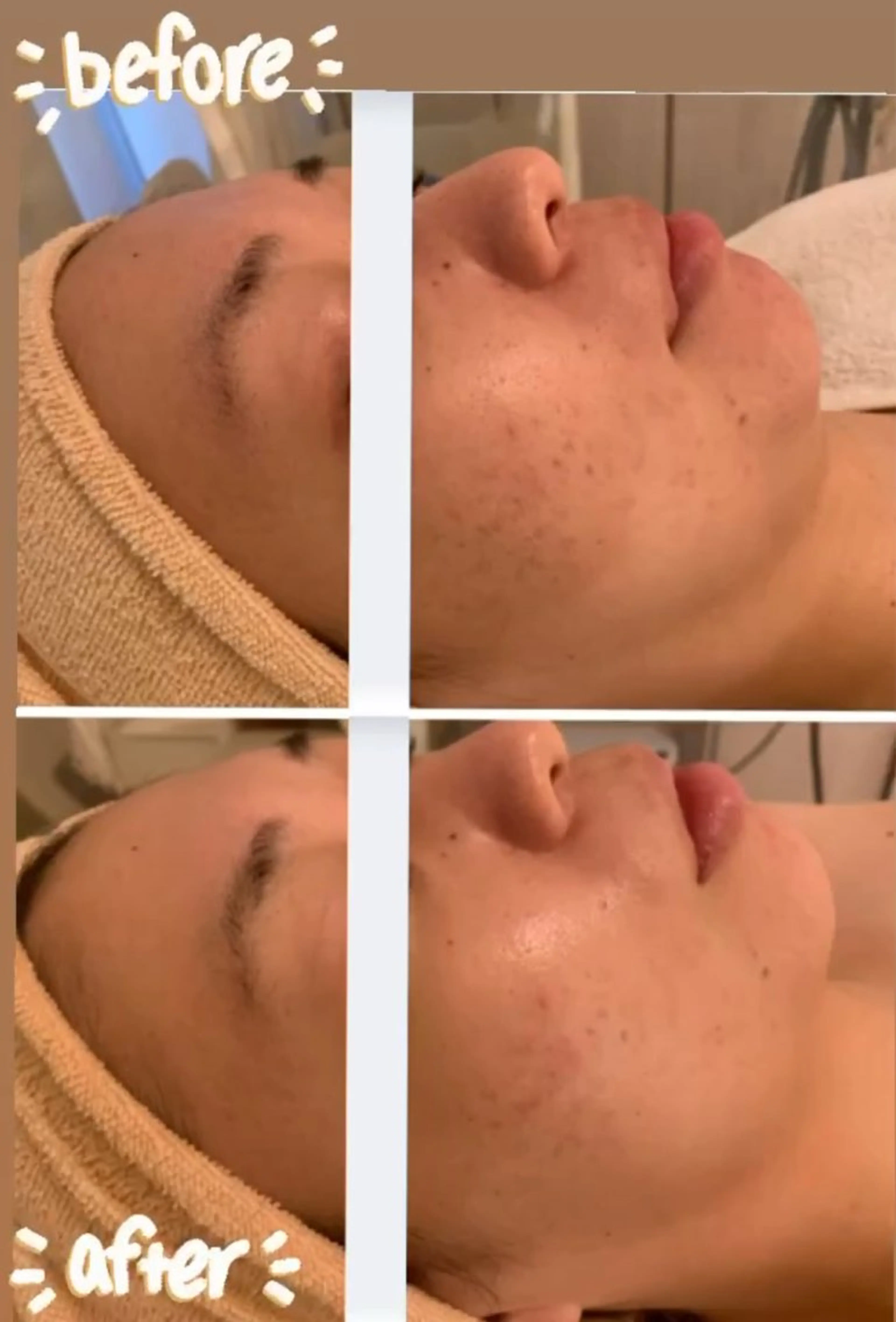 久屋大通ツヤ肌エステ KIMURAのエステ・リラクイメージ