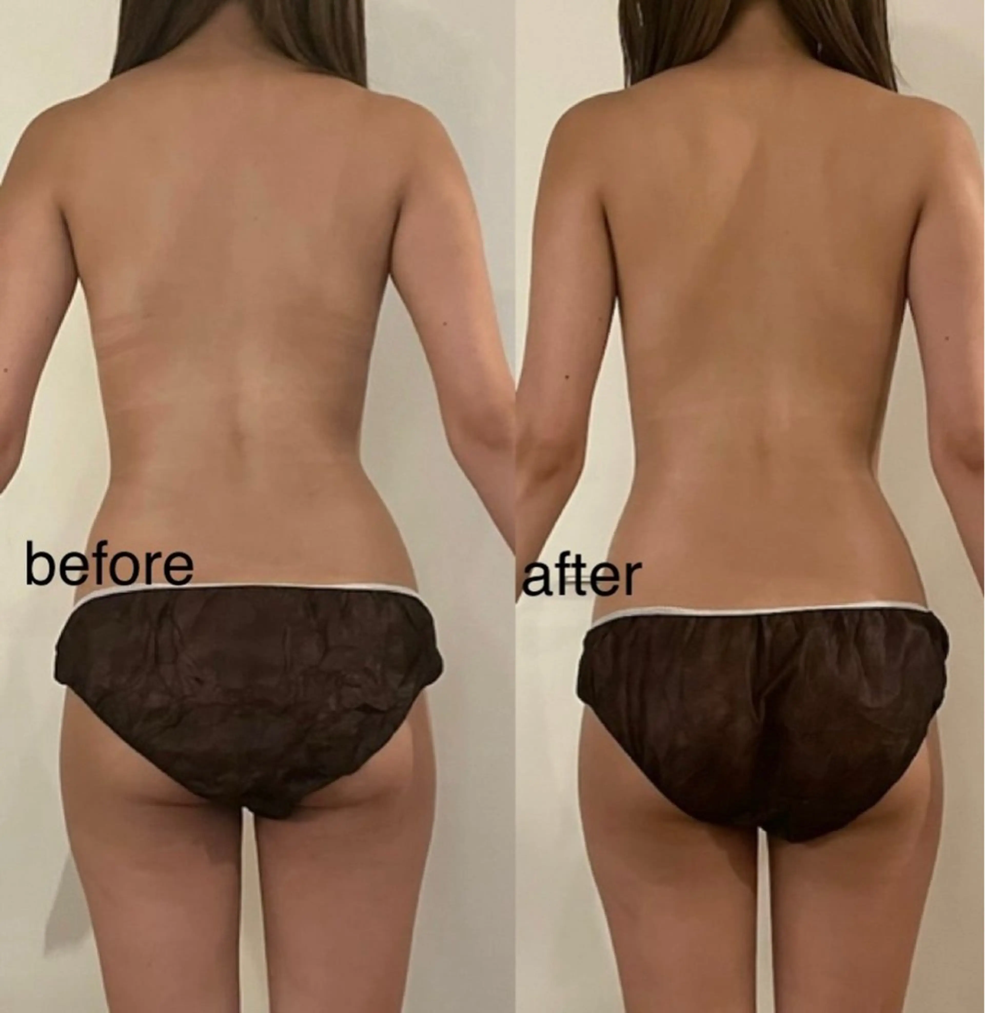 KAIZENBODY名古屋栄所属・KAIZENBODY 名古屋栄高田のエステ・リラクイメージ