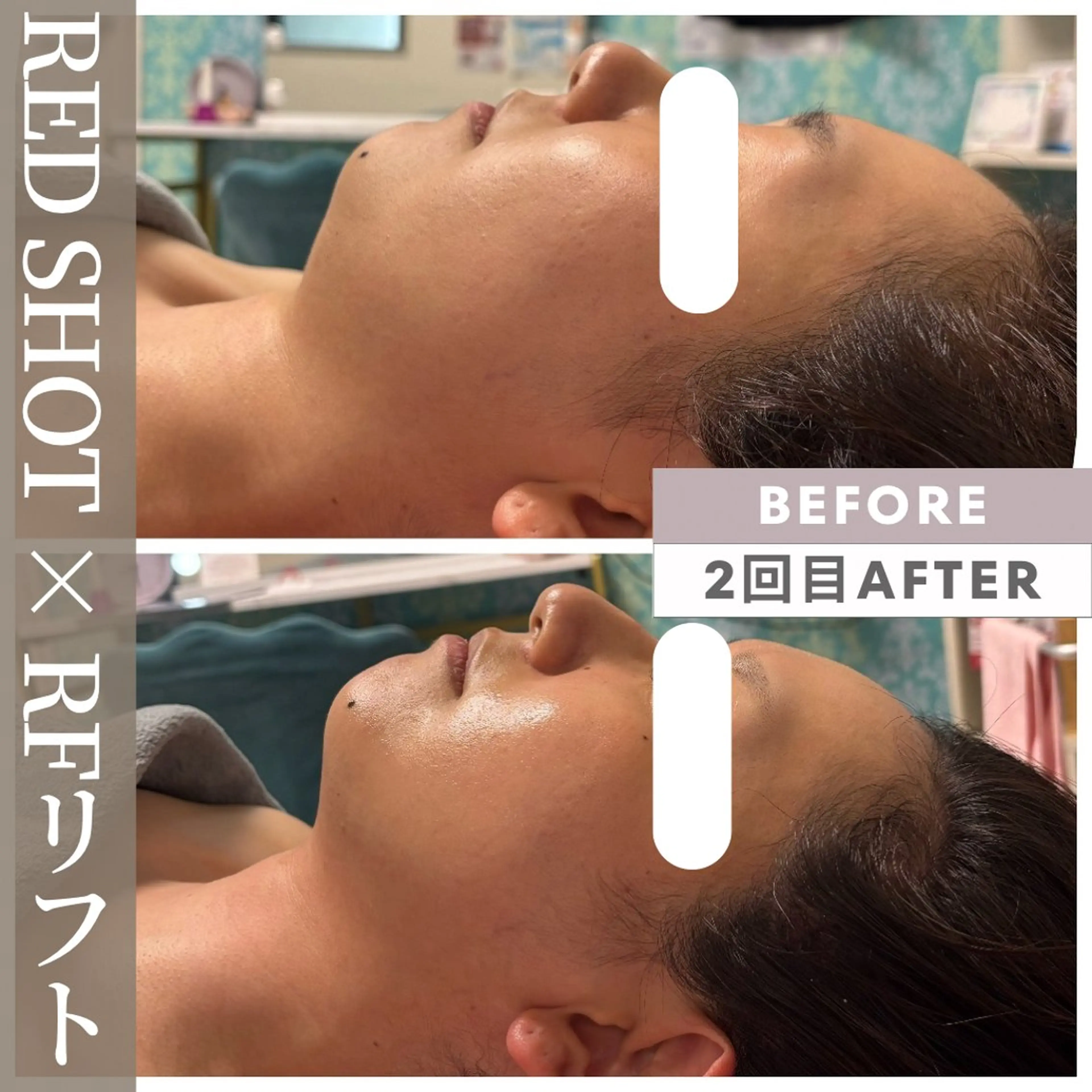 エステ リラク 小顔矯正専門店 【RED】池田のエステ・リラクイメージ