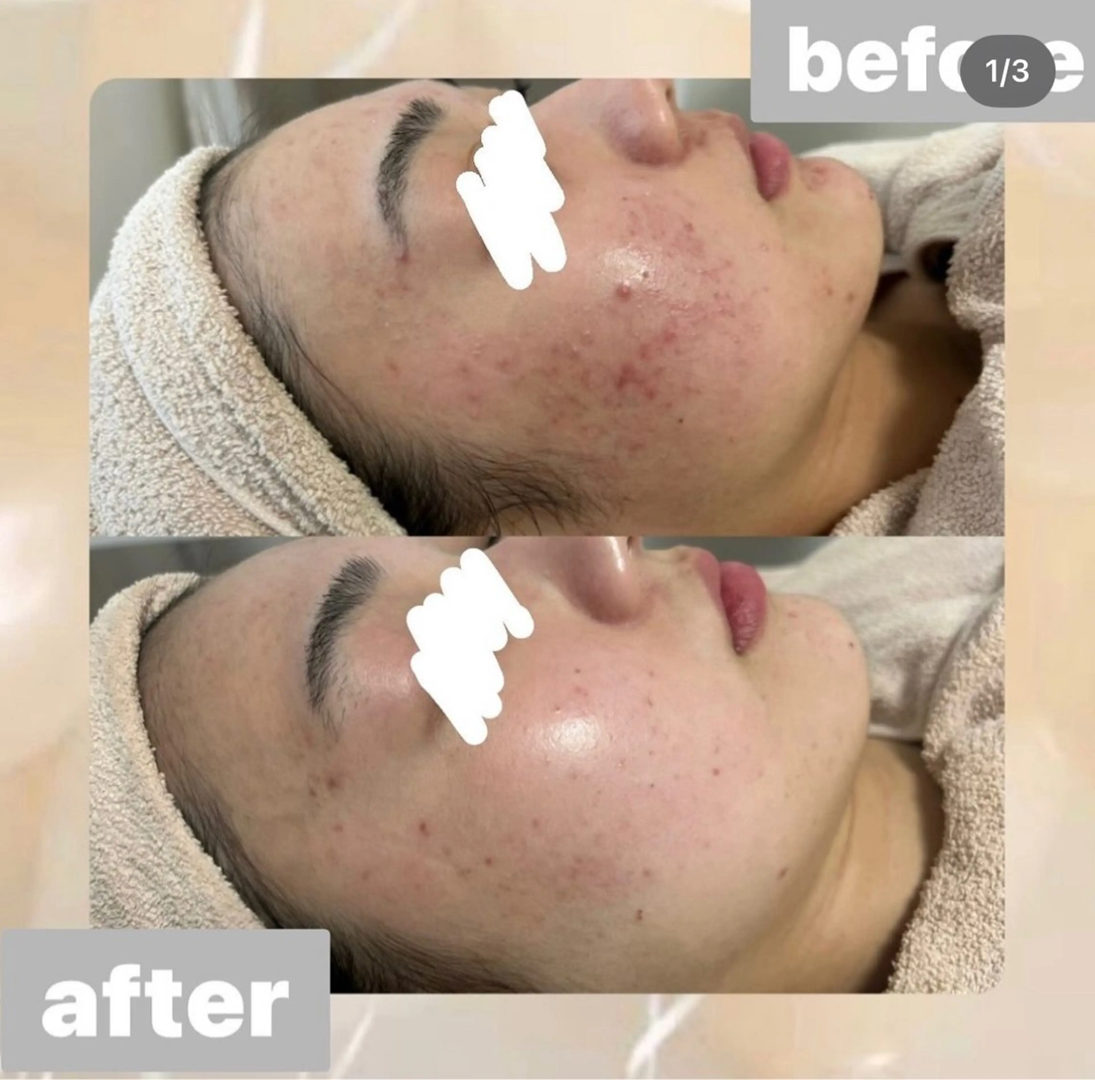 都度払い肌改善専門店 店長二上文香のエステ・リラクイメージ