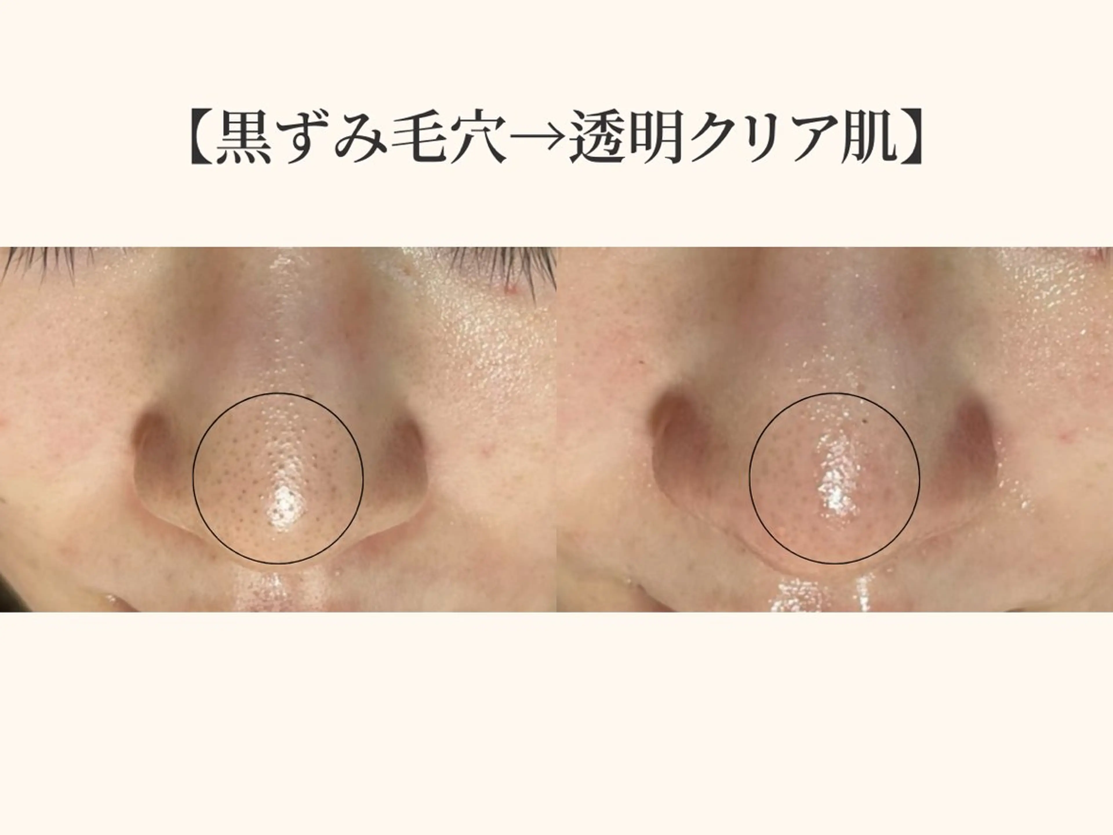 小顔矯正×毛穴サロン DRRAMSPA町田のエステ・リラクイメージ