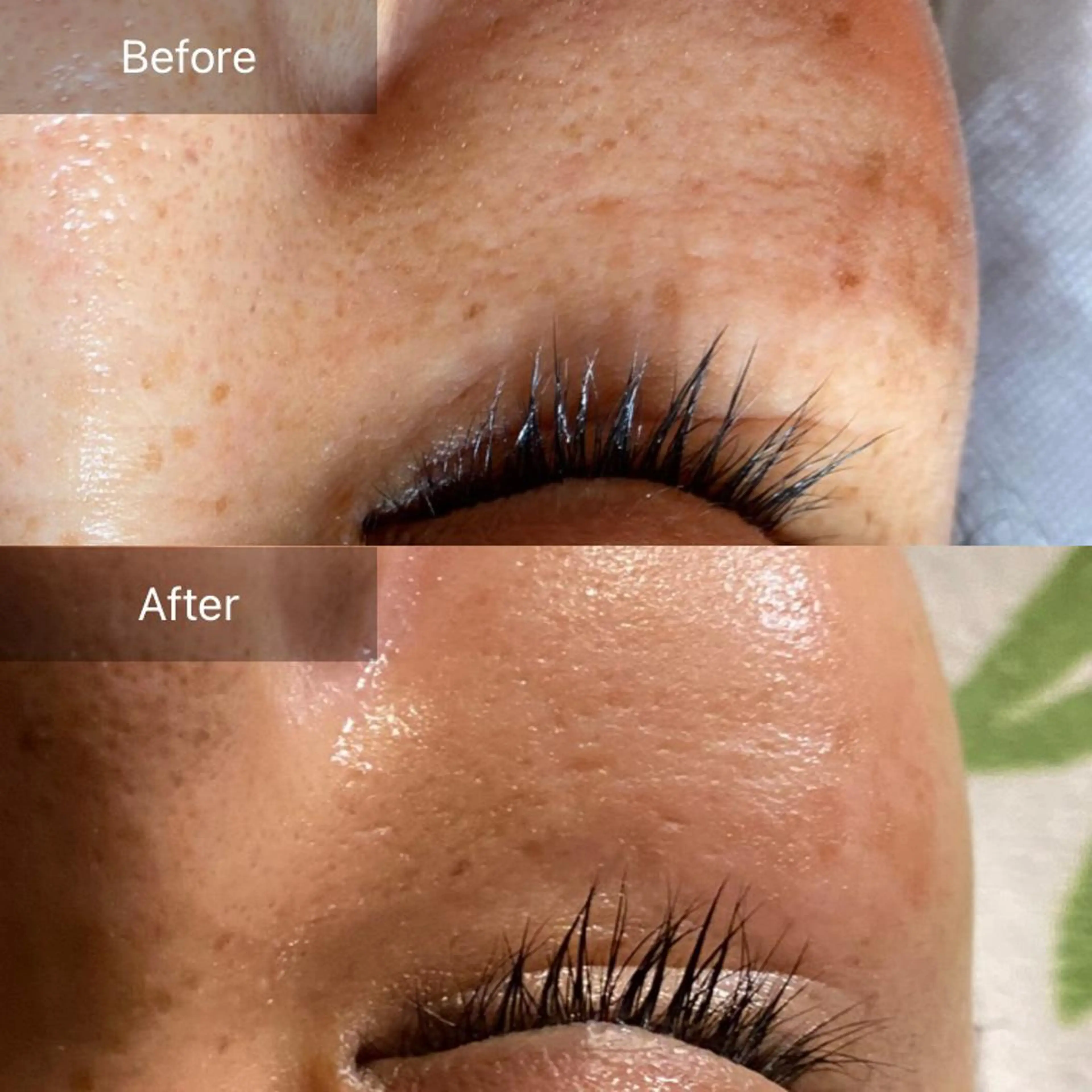 エステ Mandarin Orange所属・毛穴から始める肌メン テマンダリンオレンジのエステ・リラクイメージ