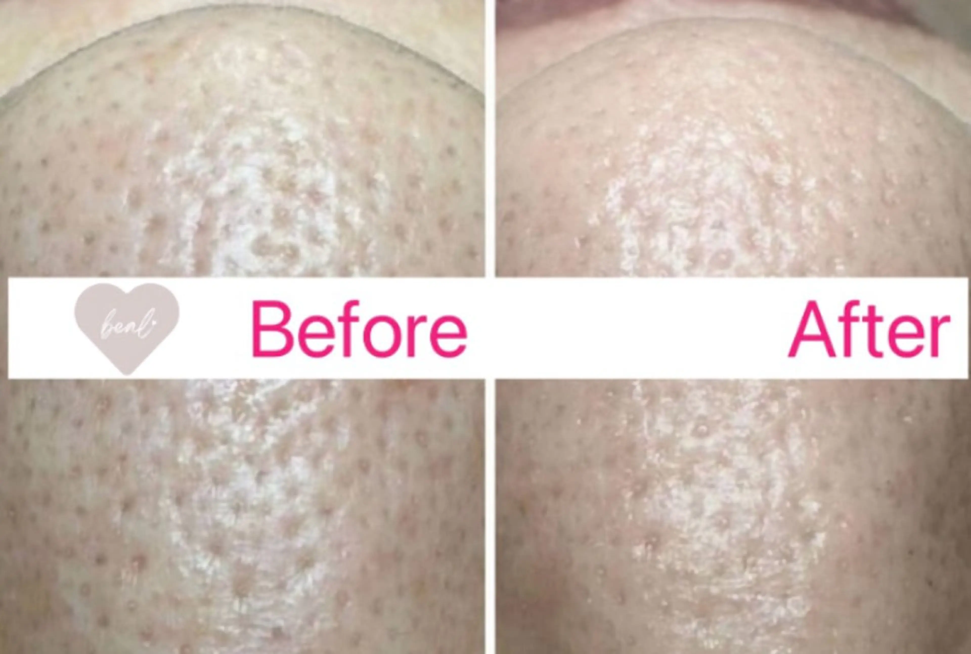 エステ べアール所属・小顔/毛穴/ニキビ salon bealのエステ・リラクイメージ