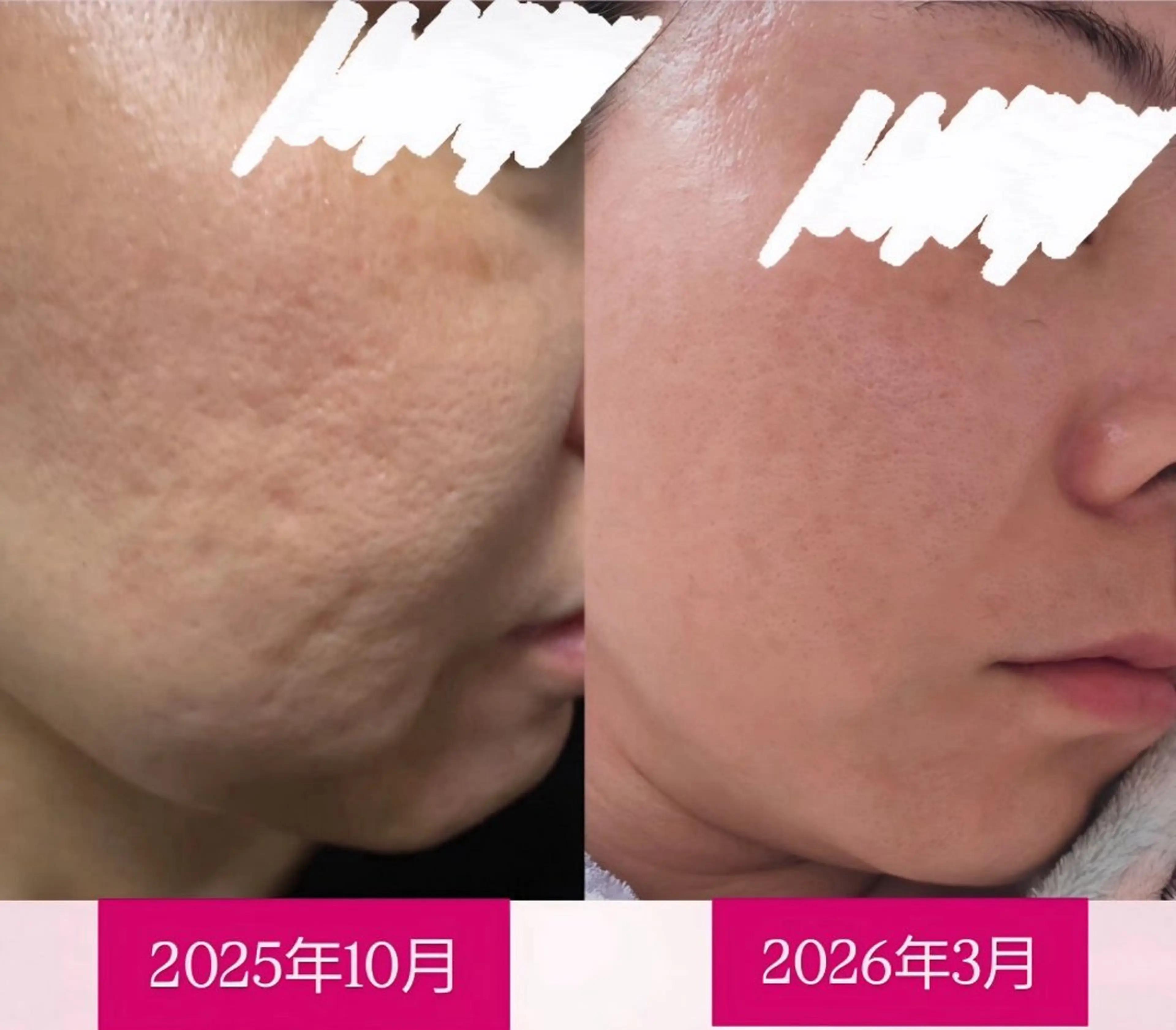 エステ 美と健康サロン Lino leaのエステ・リラクイメージ