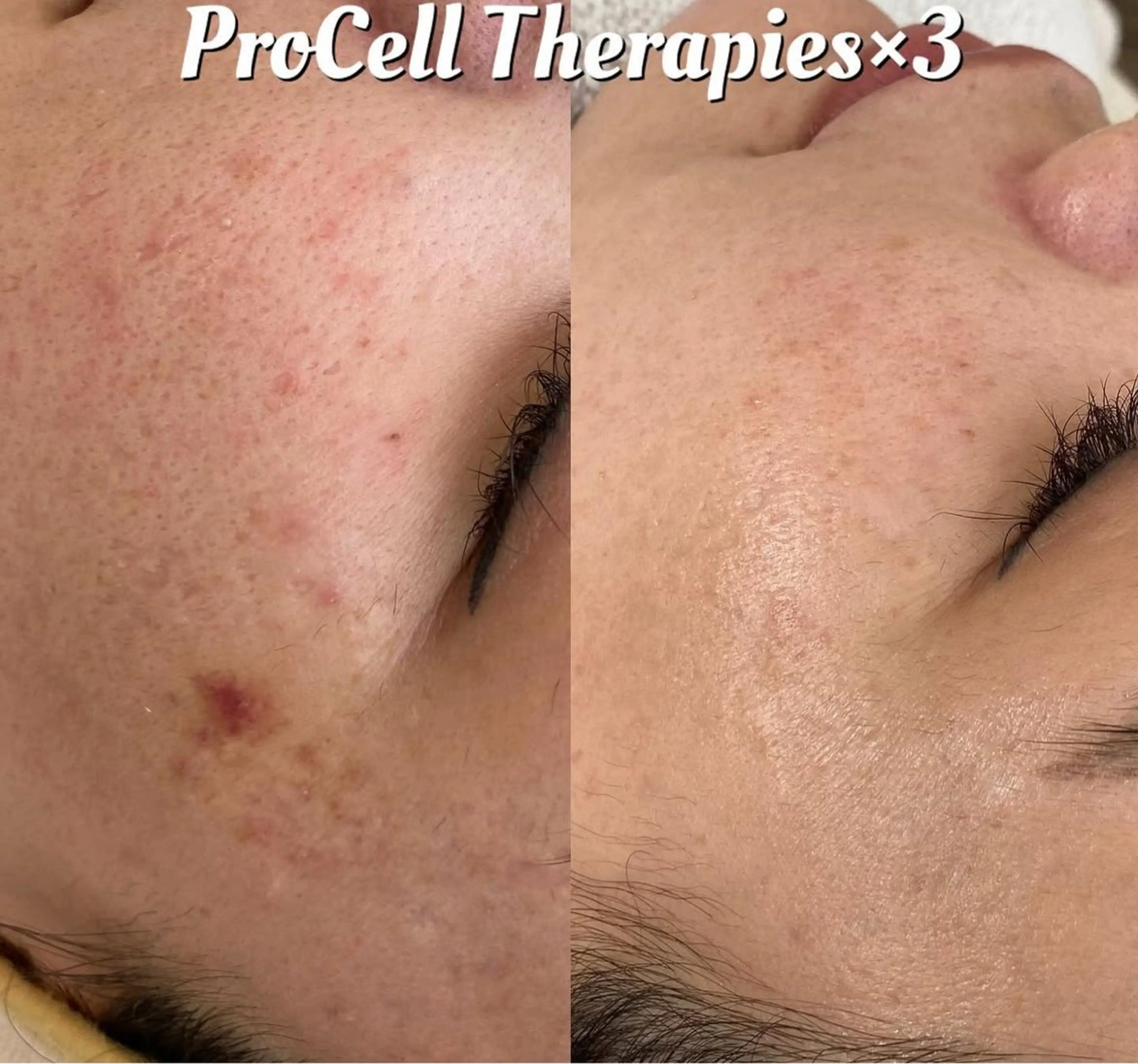 LOUISE. ／肌質・頭皮のエステ・リラクイメージ