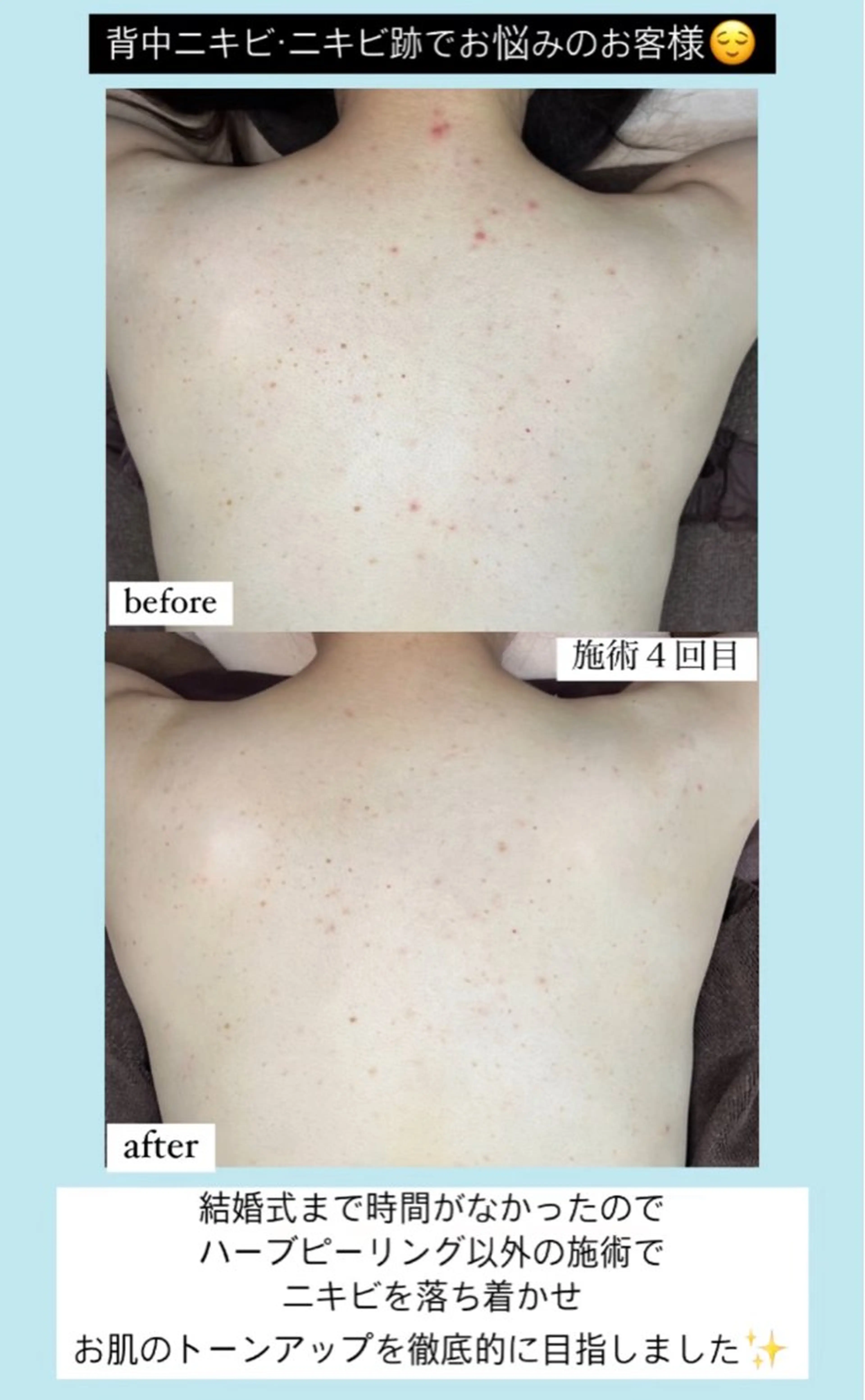 エステ ベラージュ【美背中・ 美尻・フェイシャル】のエステ・リラクイメージ