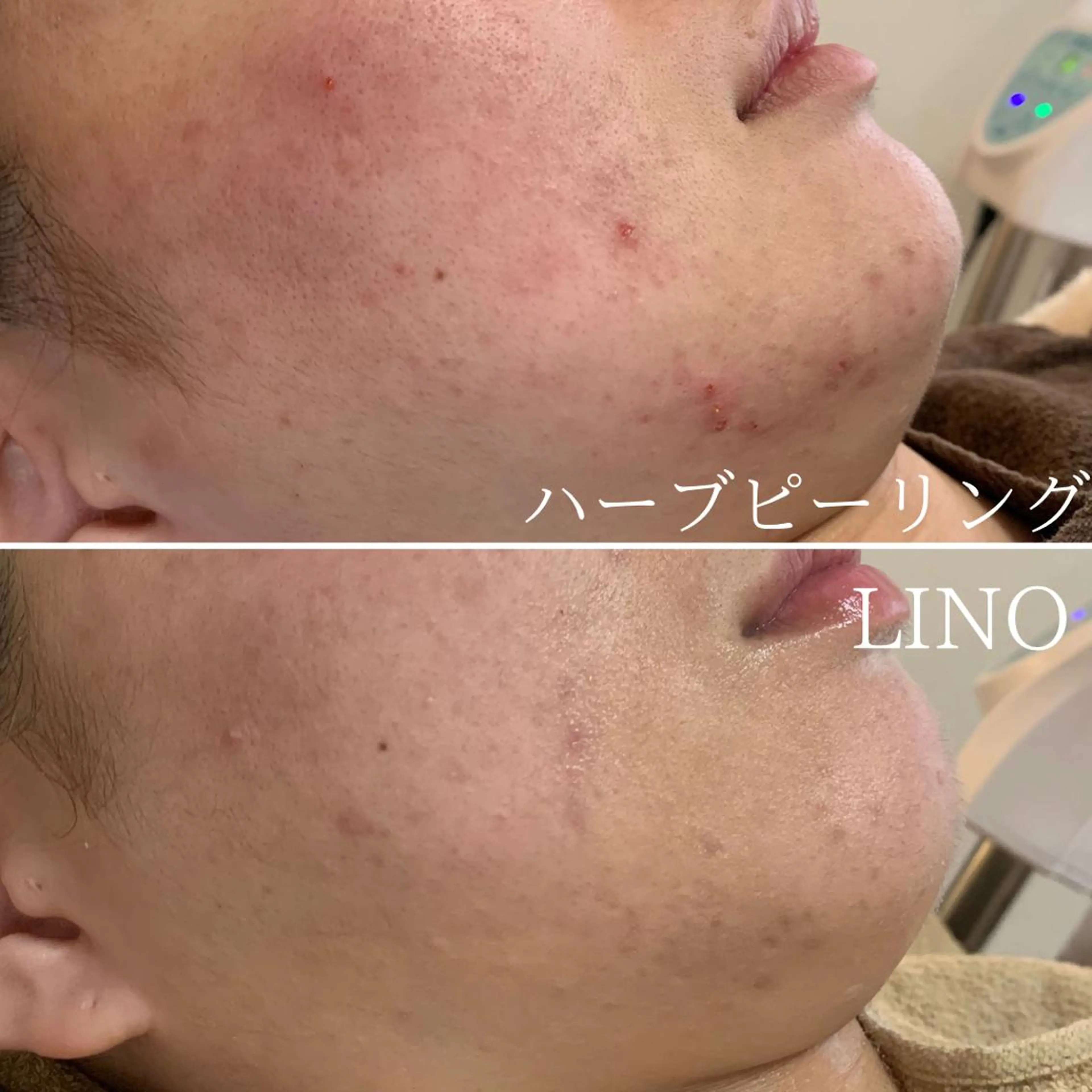 平日昼間限定★ 全メニュ¥6600のエステ・リラクイメージ