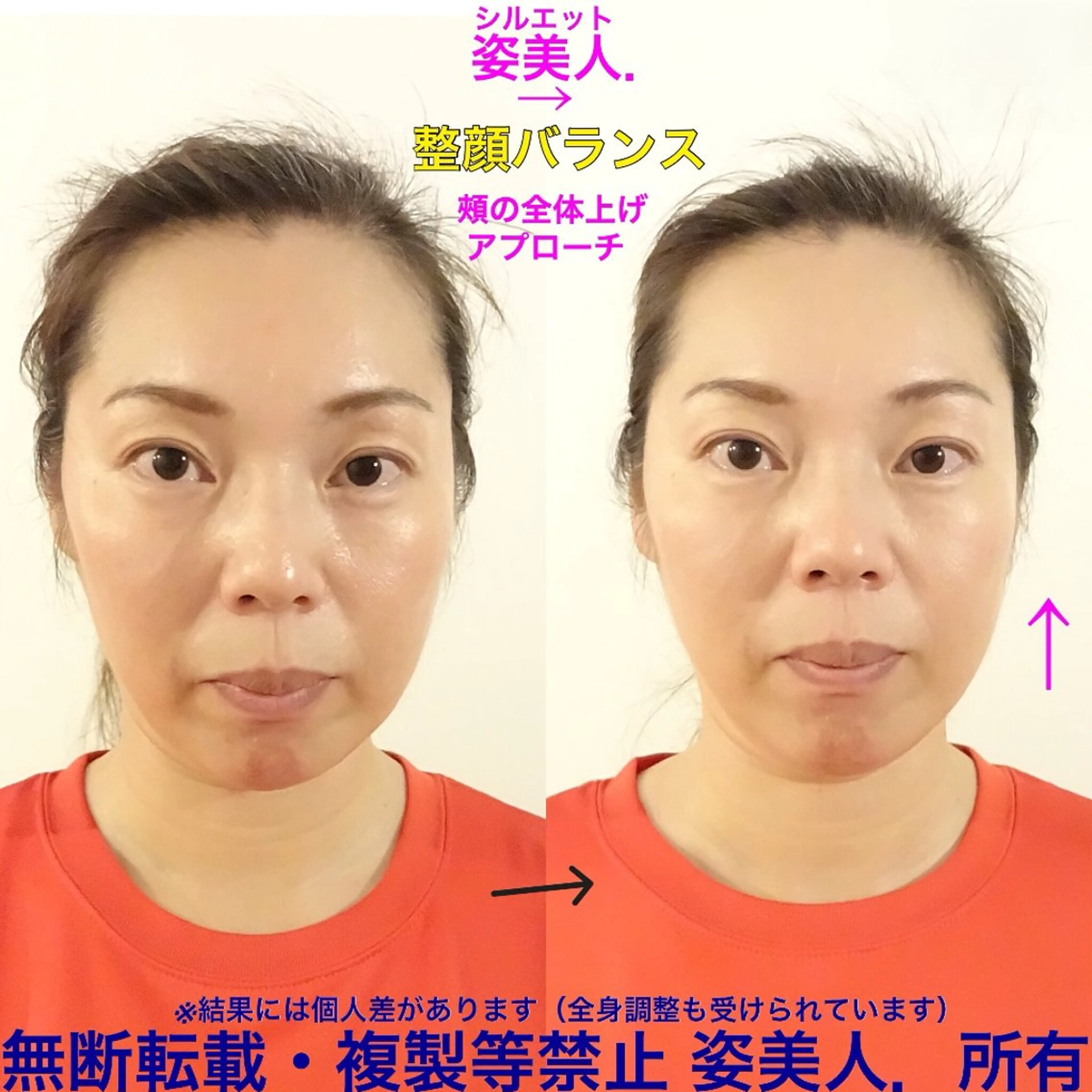 筋膜整体＆小顔矯正 　姿美人.シルエットのエステ・リラクイメージ