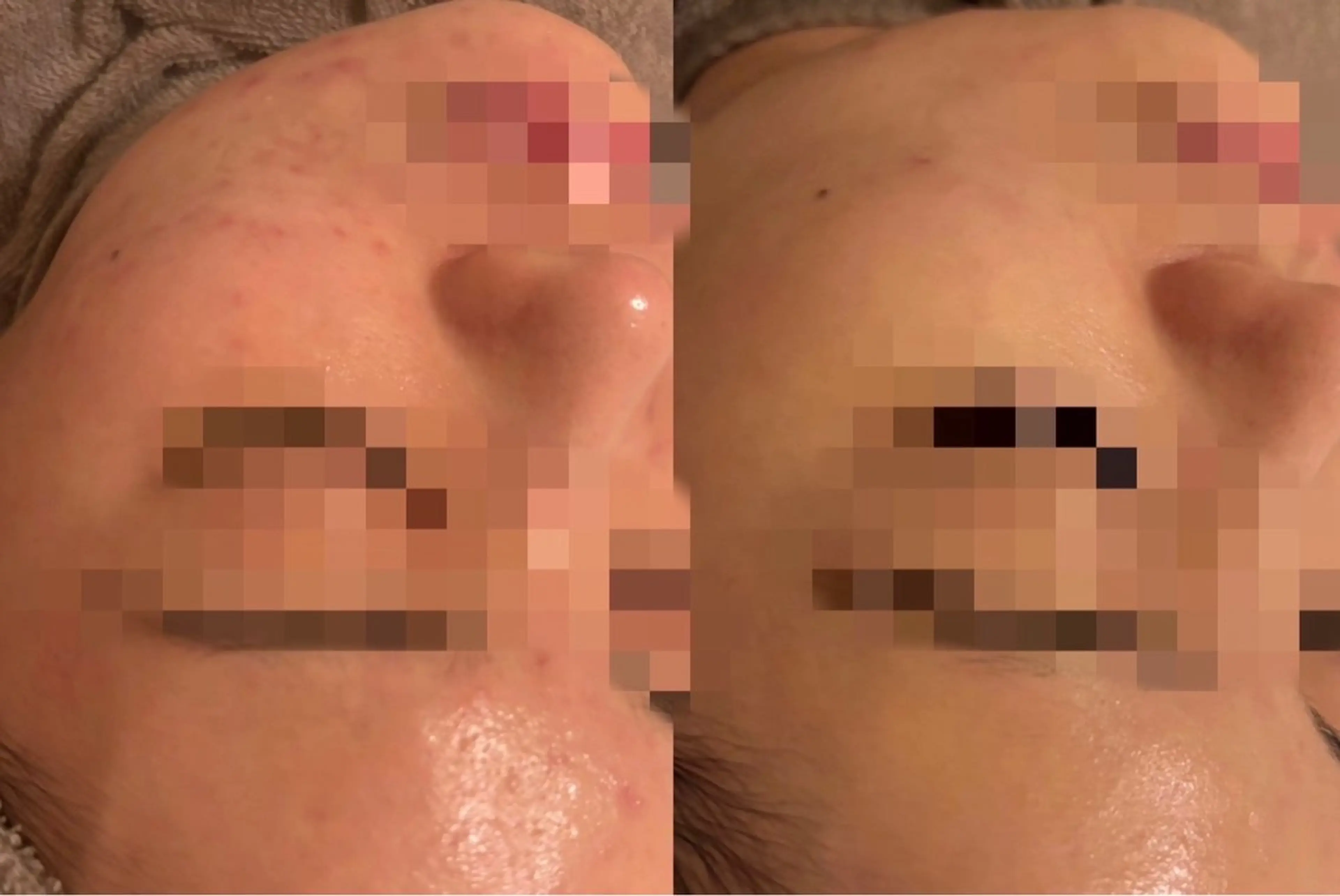 RUA KAHOのエステ・リラクイメージ