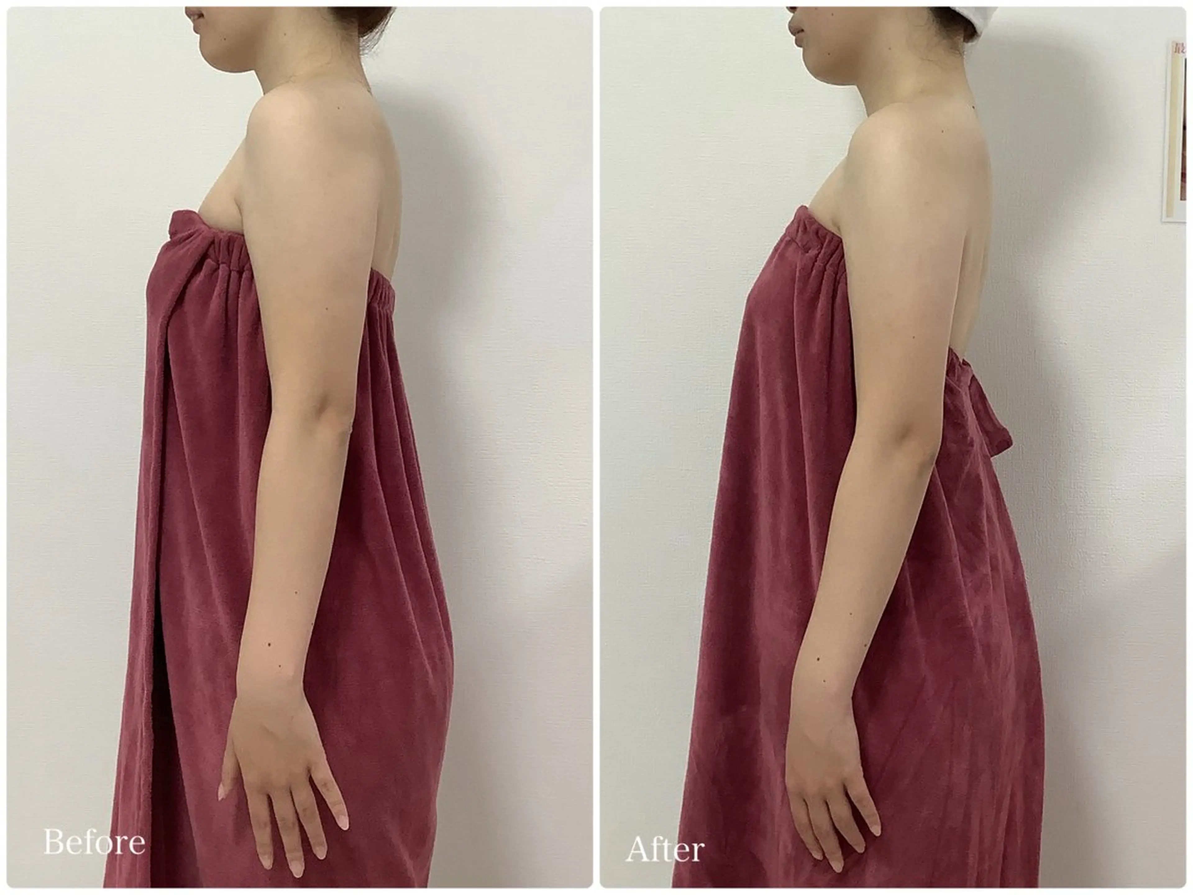 エステ LiAm《美肌管理/ 小顔/脂肪ケア》のその他イメージ