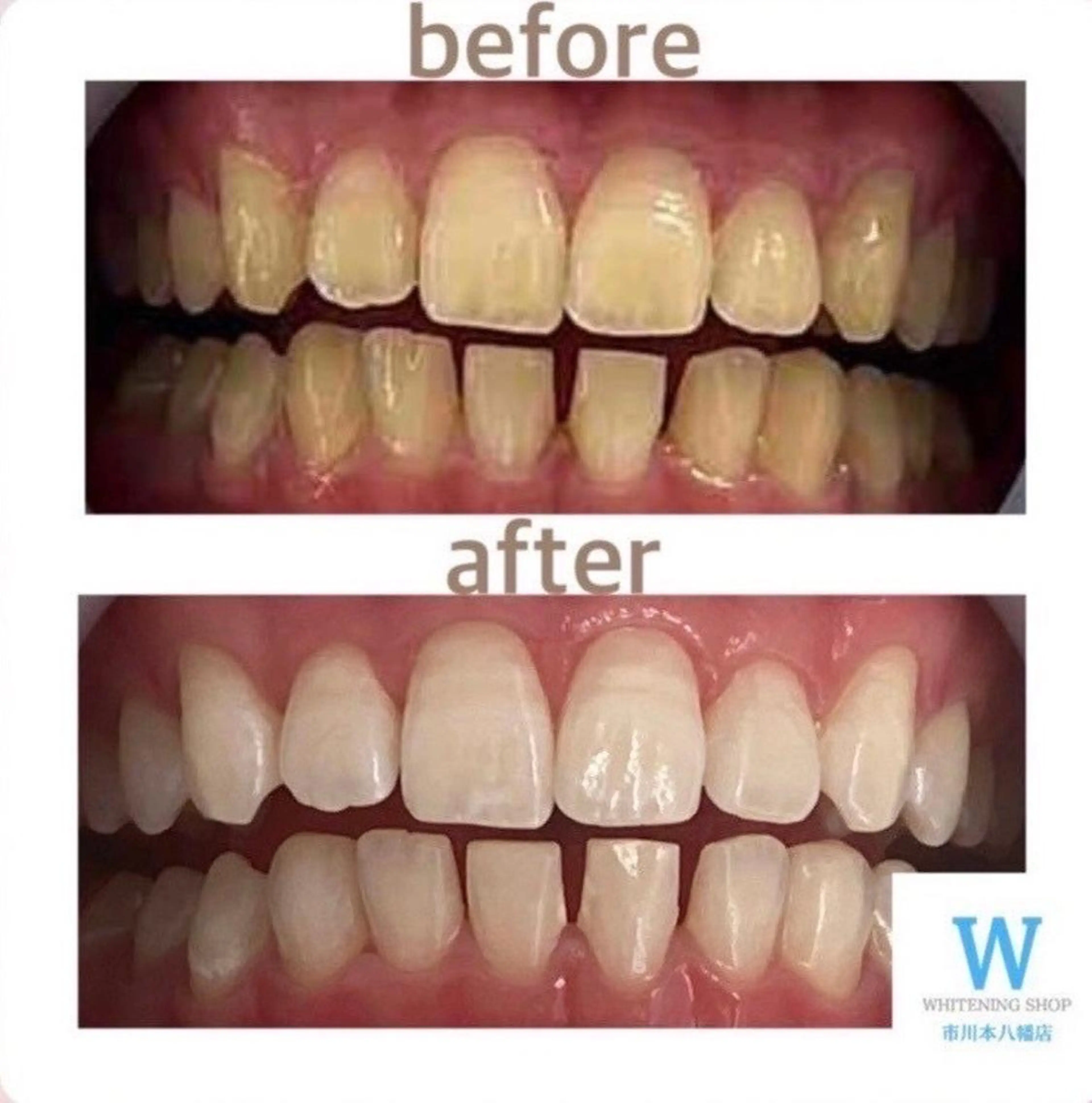 ホワイトニング ショップ本八幡店のエステ・リラクイメージ