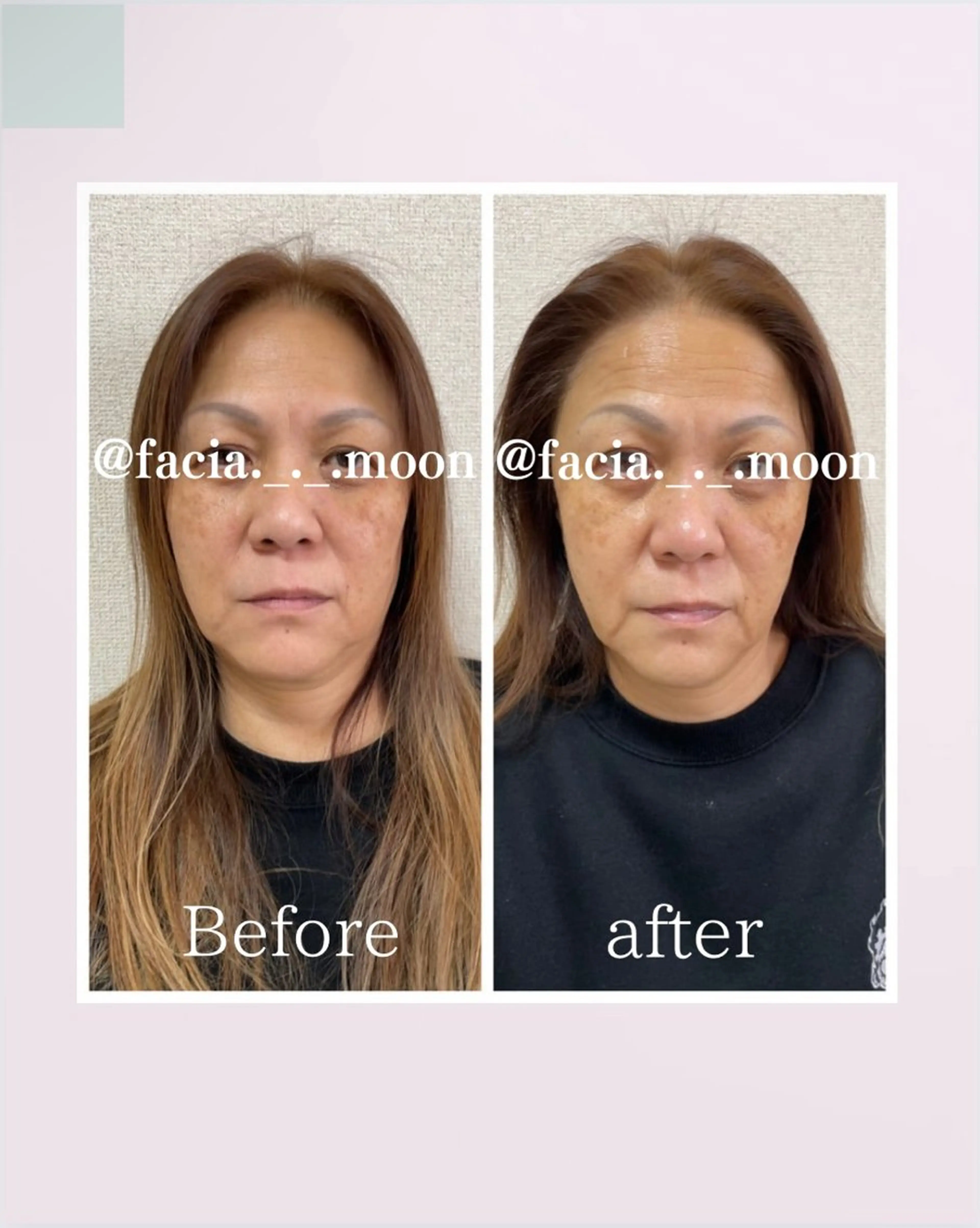 肌質改善サロン facialmoonのエステ・リラクイメージ