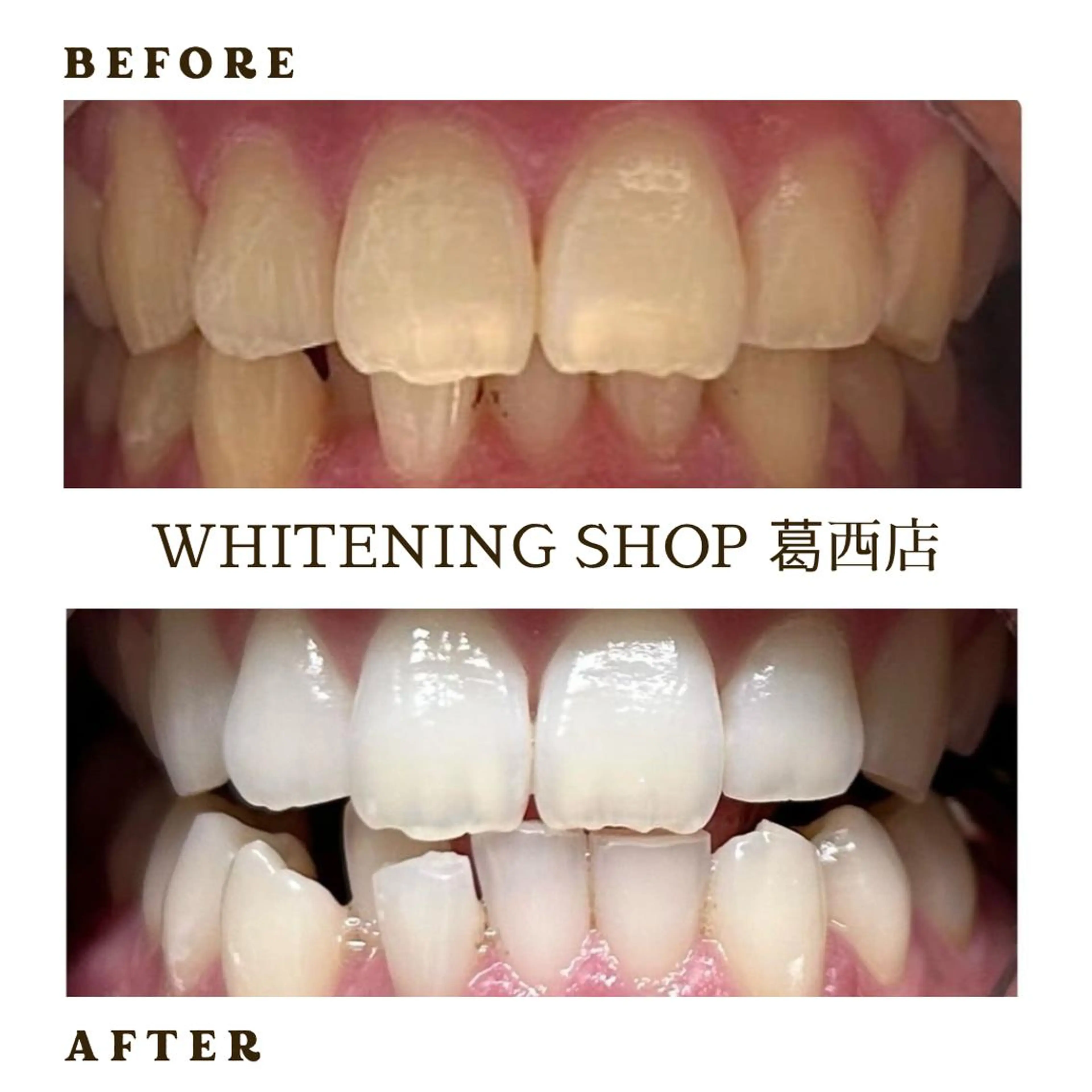 メンズ 学生(メンズ向け) その他 ホワイトニング ショップ葛西店のその他イメージ