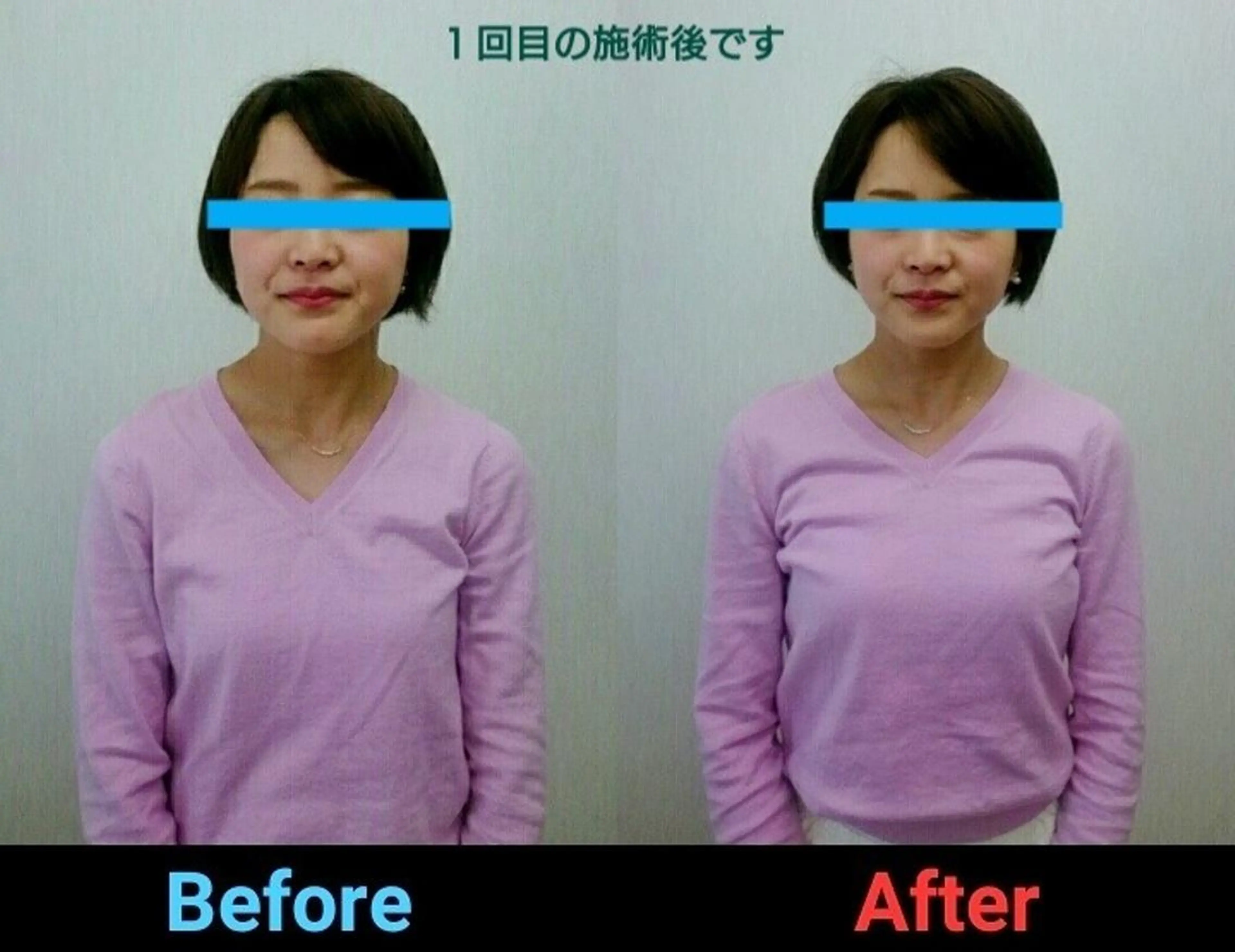 ブライト整体🟠 肩こり•腰痛•首こりのエステ・リラクイメージ